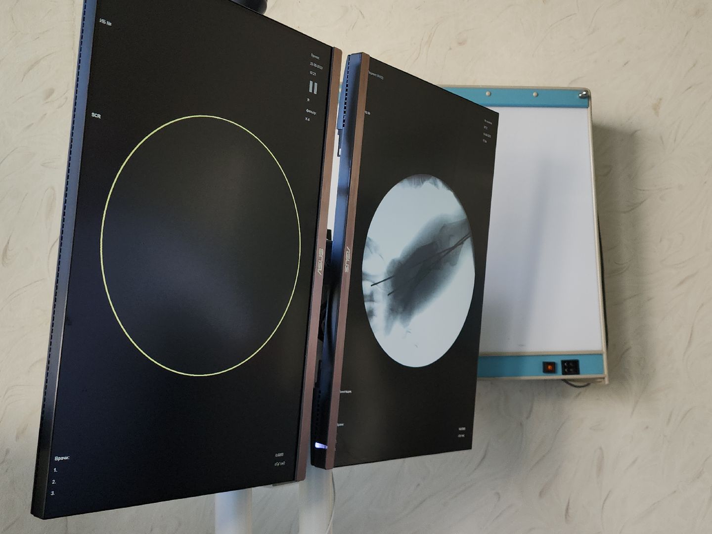 медицина, рентген, новая аппаратура, видное, проект здравоохранение, подмгсковье,