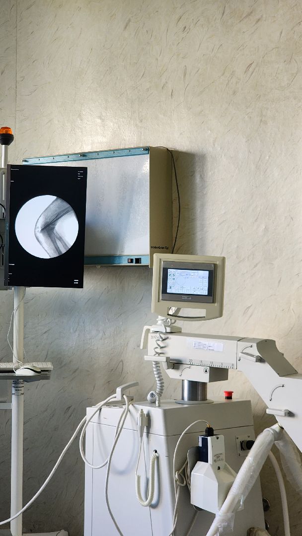 медицина, рентген, новая аппаратура, видное, проект здравоохранение, подмгсковье,