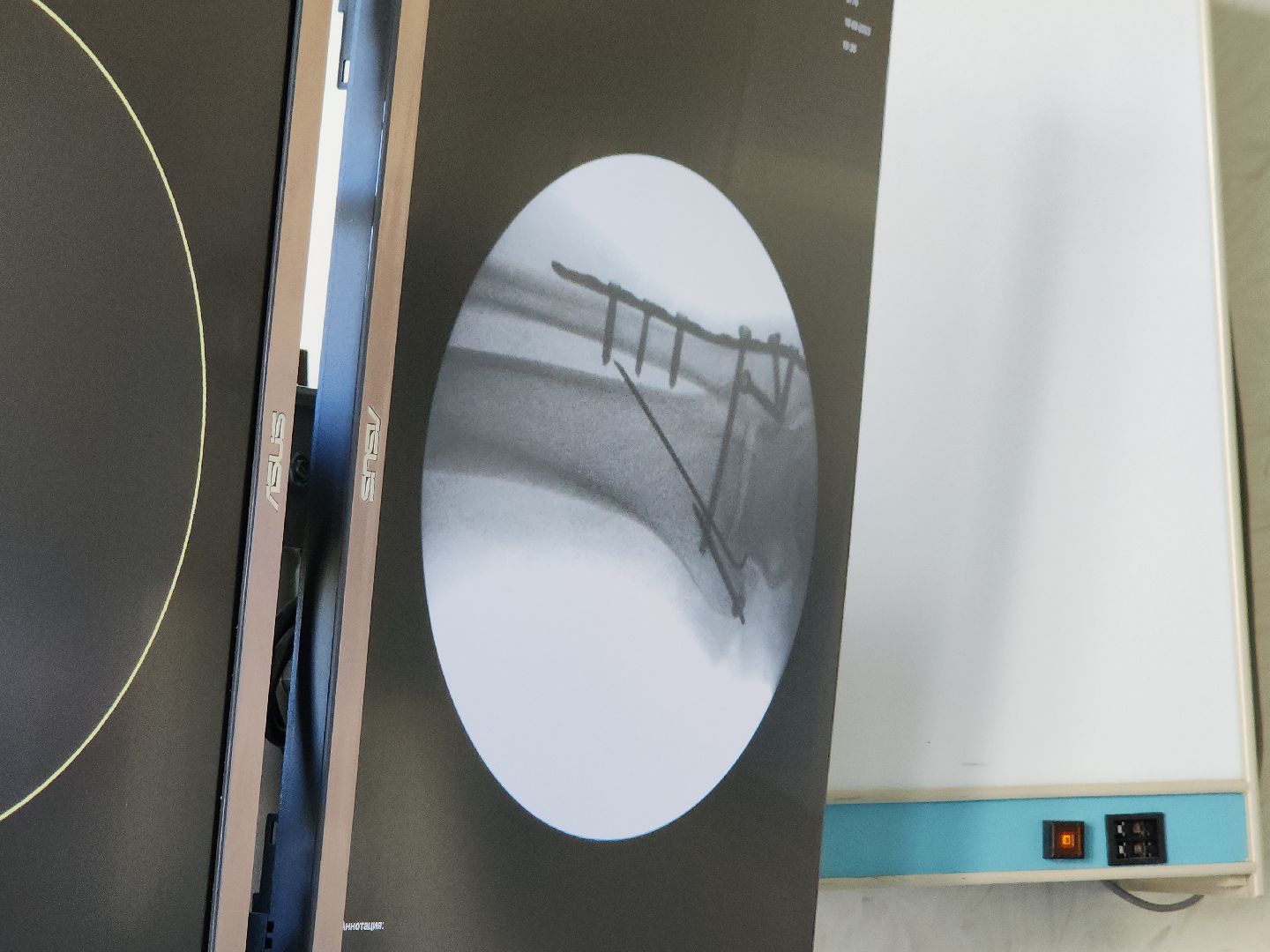 медицина, рентген, новая аппаратура, видное, проект здравоохранение, подмгсковье,