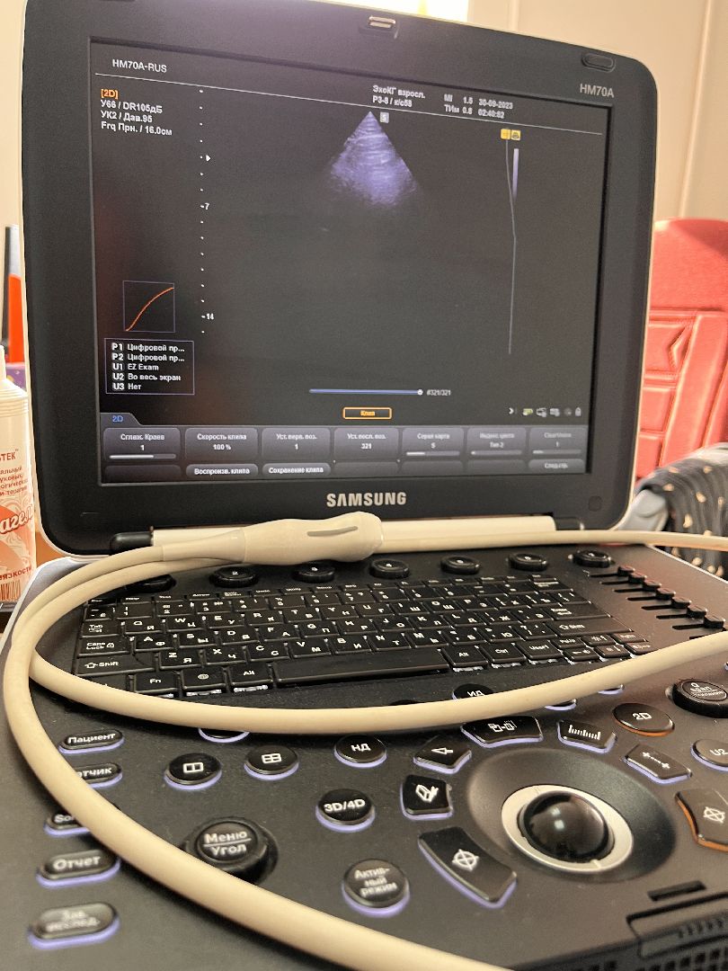 здравоохранение, здравоохранение подмосковья, кардиология, руза, рузский городской округ, медицина, московская область, подмосковье,