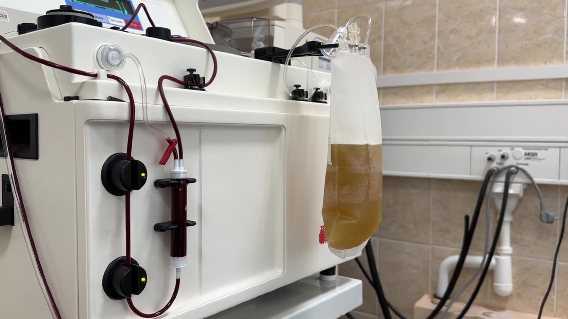 Реутов, медицина, плазма, кровь, рак, поазмаферез, гемодиализ, ЦГКБ,