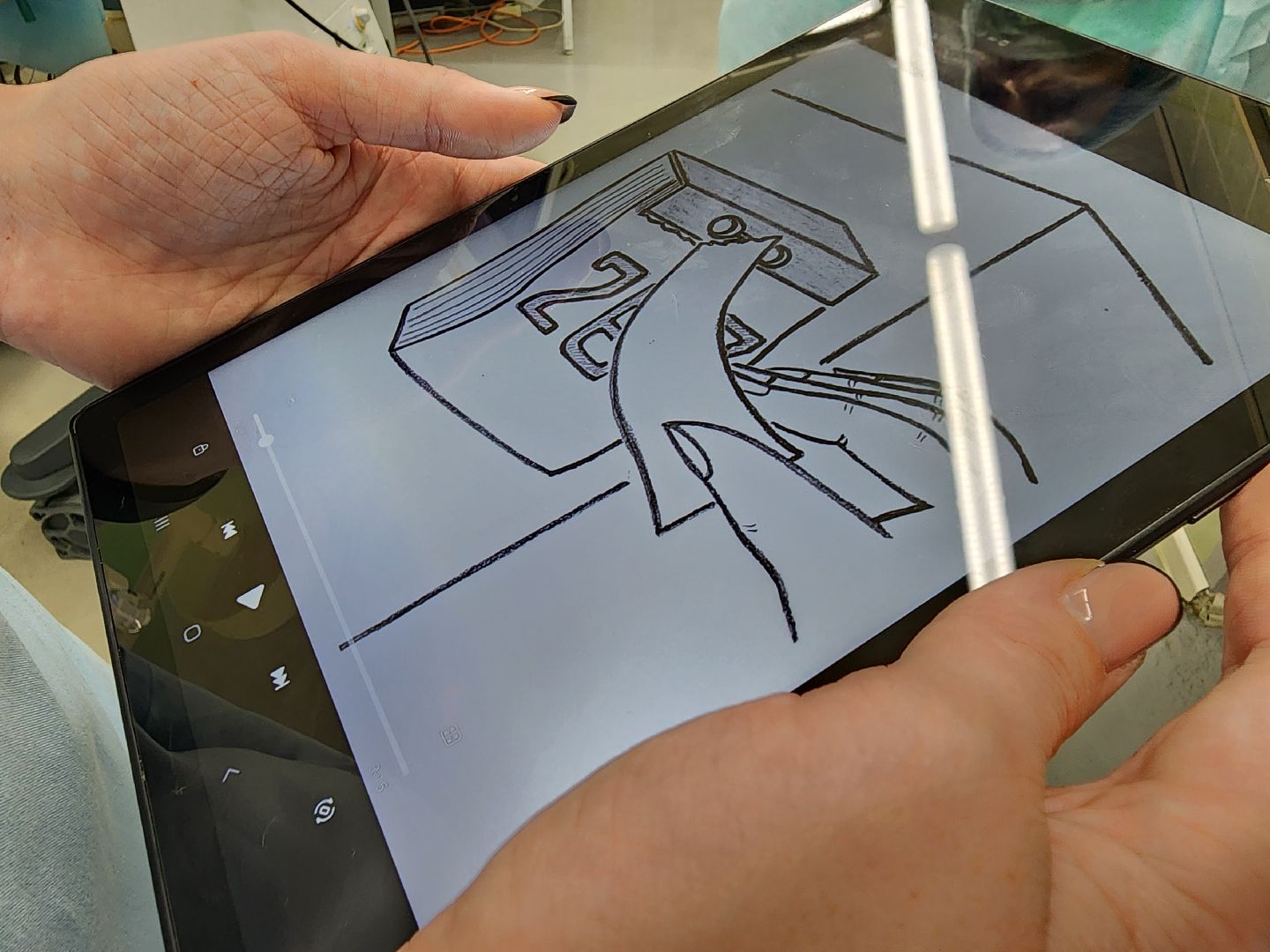 Медицина, Подольск, Подольская больница, Операция, Технологии, нейрохирургия,