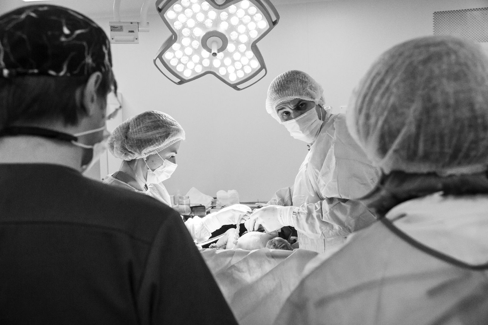 Обвитие пуповиной, Спасение новорожденного, наро-фоминский перинатальный центр, Неонатологи Подмосковья,