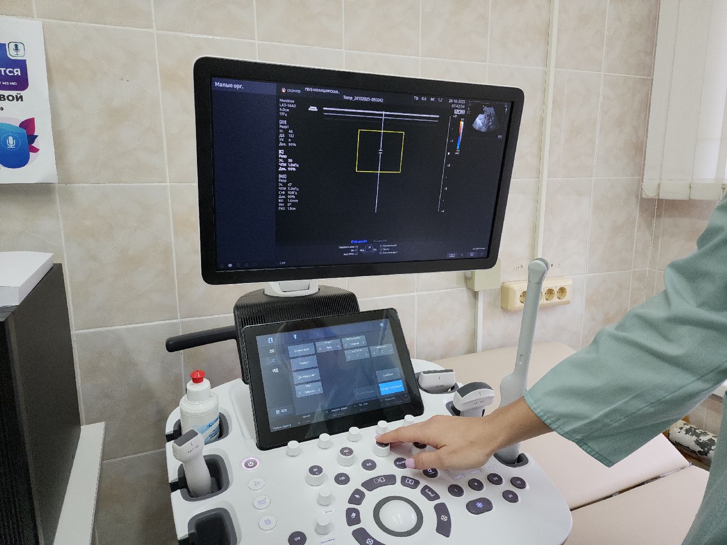 кашира, Каширская ЦРБ, аппарат УЗИ, РуСкан 65, патологии, молочные железы, женская консультация,