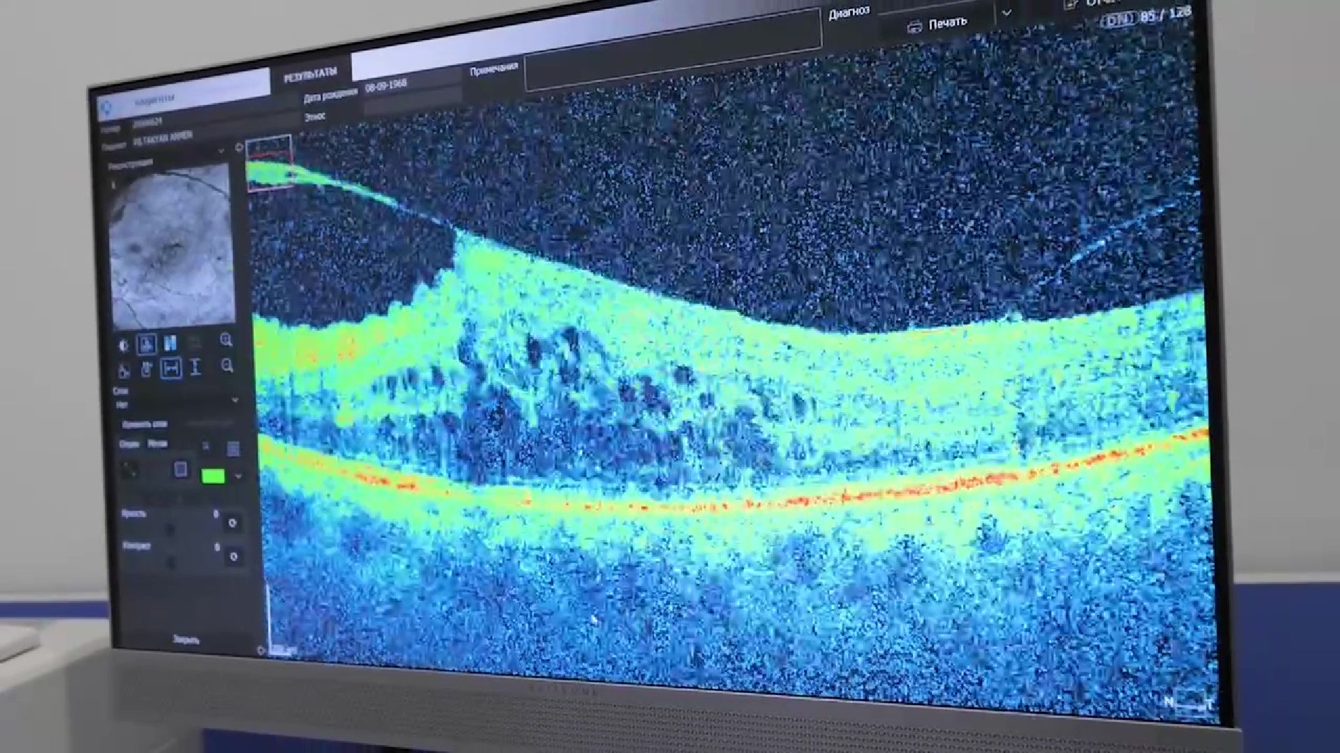 Реутов, офтальмология, зрение, общество слепых, бесплатная помощь,