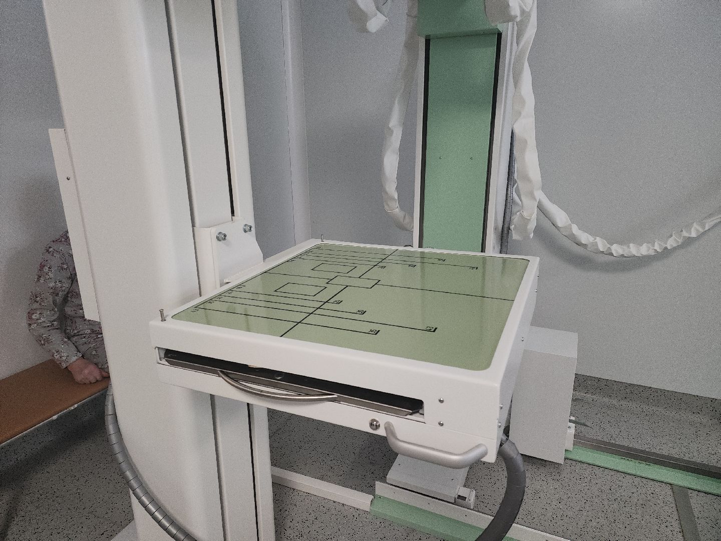 кашира, ожерелье, хирургия, рентген-аппарат, новое оборудование, р-500 дуограф,