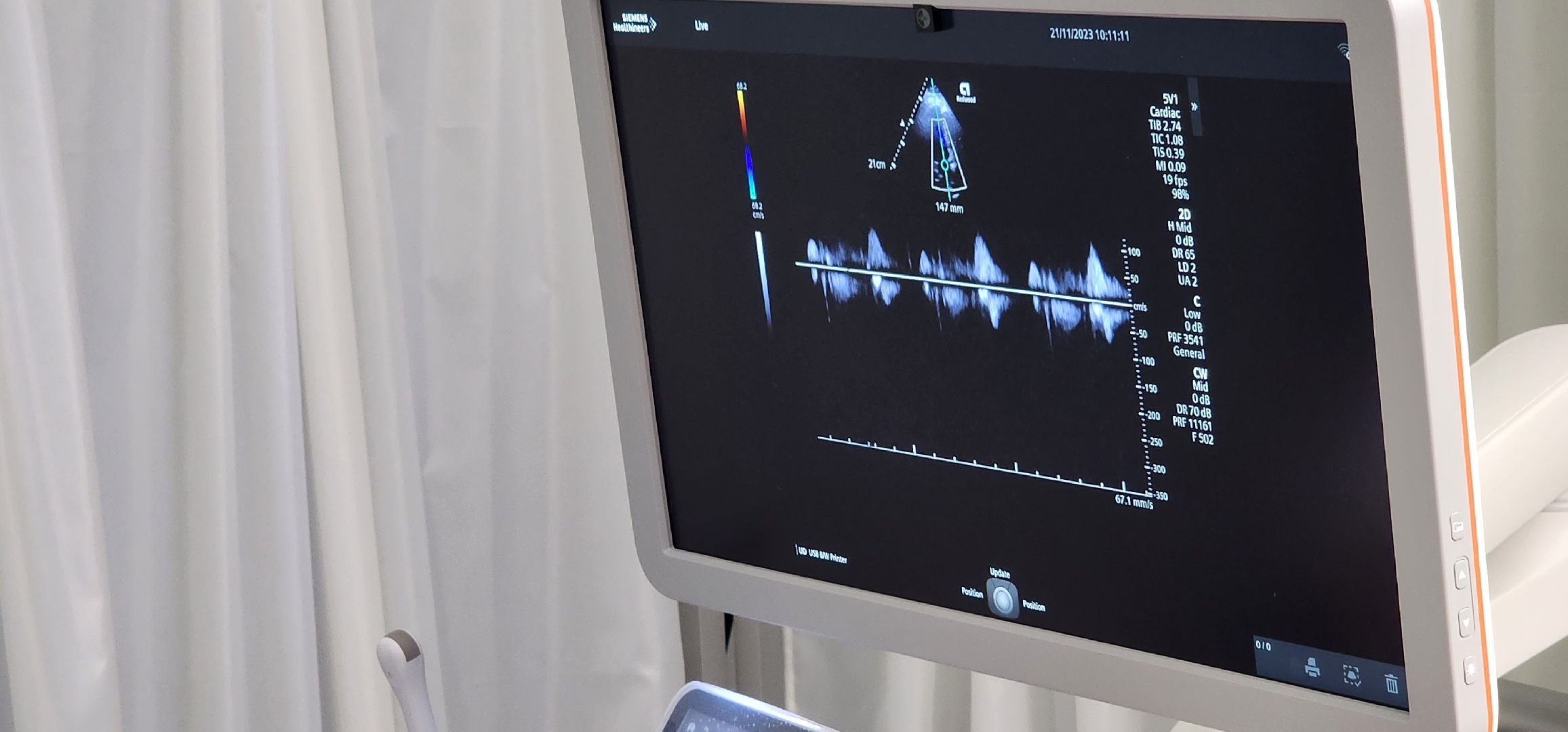 новое оборудование, медицина Подмосковья, УЗИ, поликлиника 2, Домодедово,