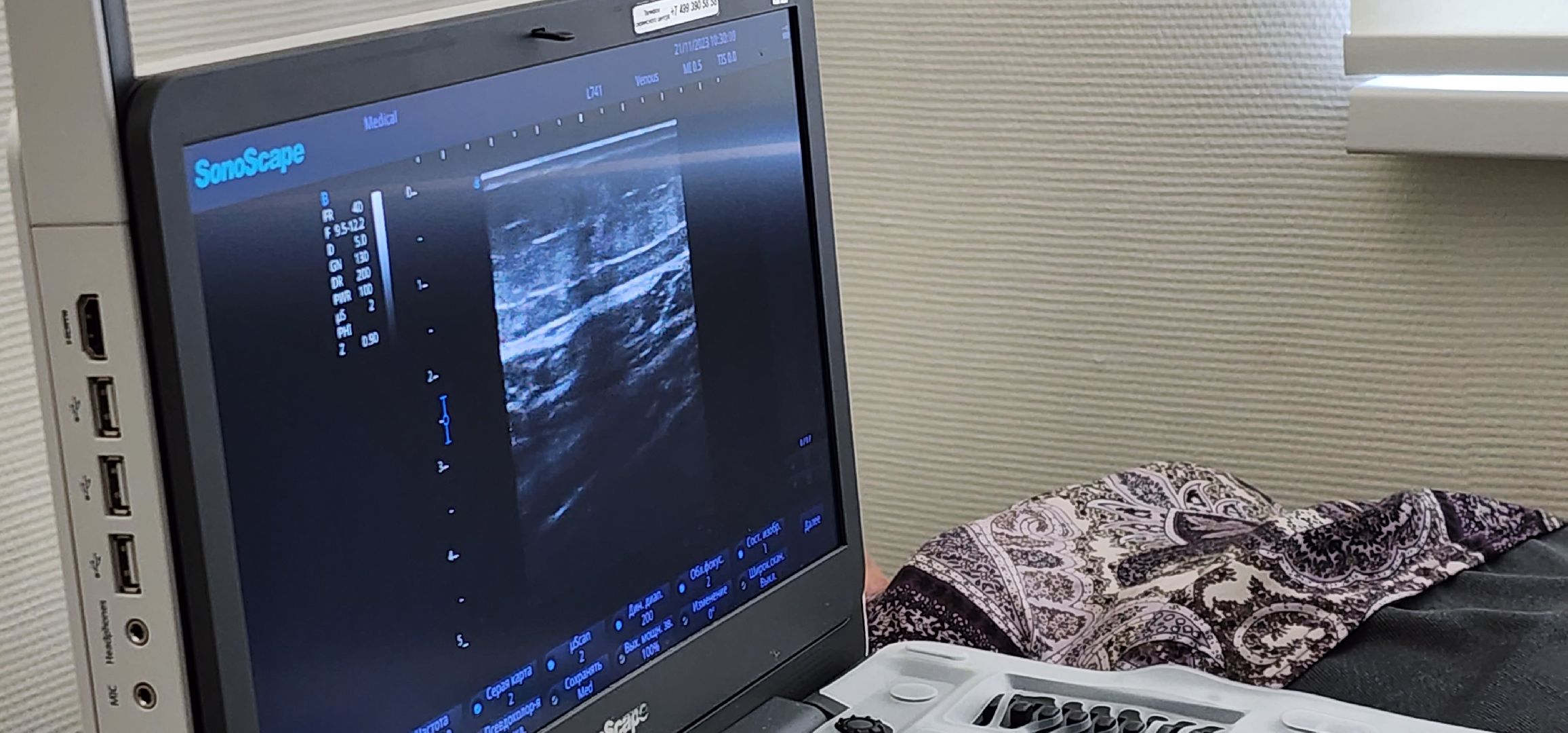 новое оборудование, медицина Подмосковья, УЗИ, поликлиника 2, Домодедово,