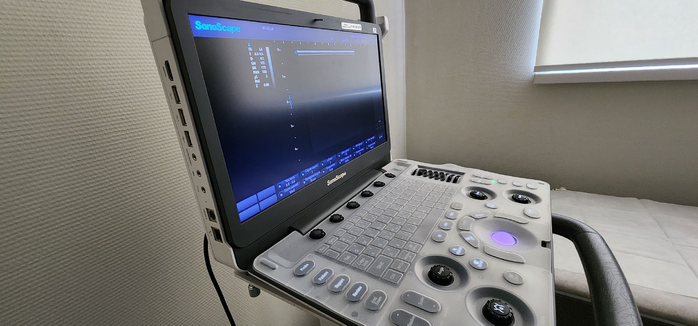 новое оборудование, медицина Подмосковья, УЗИ, поликлиника 2, Домодедово,