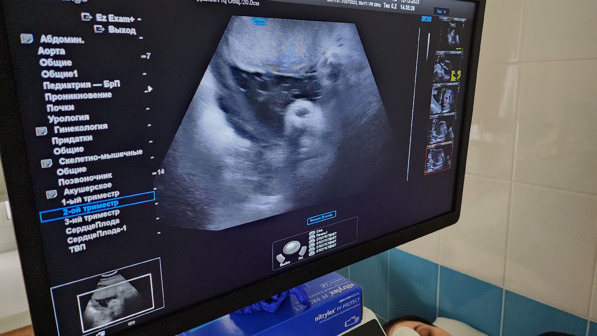 Солнечногорск, медицина, женщины, акушерство, беременность,