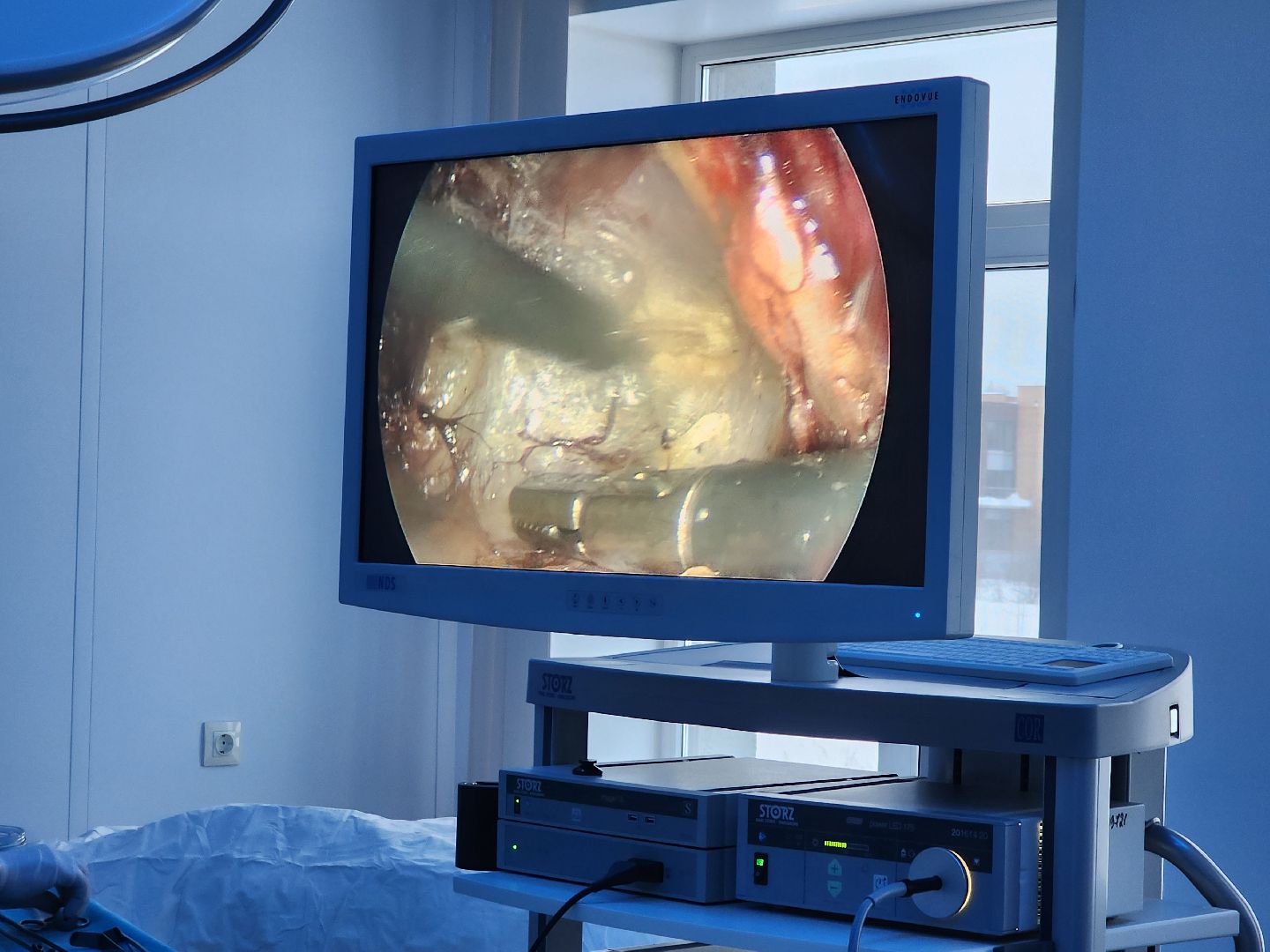 хирургия, малоинвазивные операции,