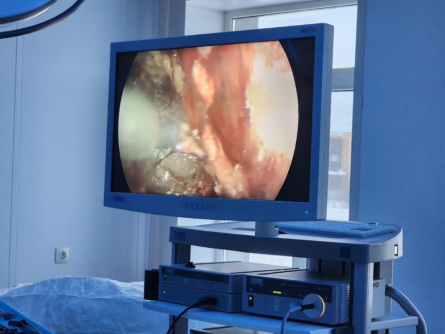 хирургия, малоинвазивные операции,