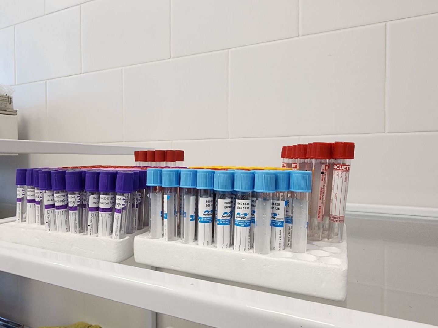 диспансеризация, день семейного здоровья, медицина, медицина подмосковья, Лосино-Петровский, Щелковская больница,