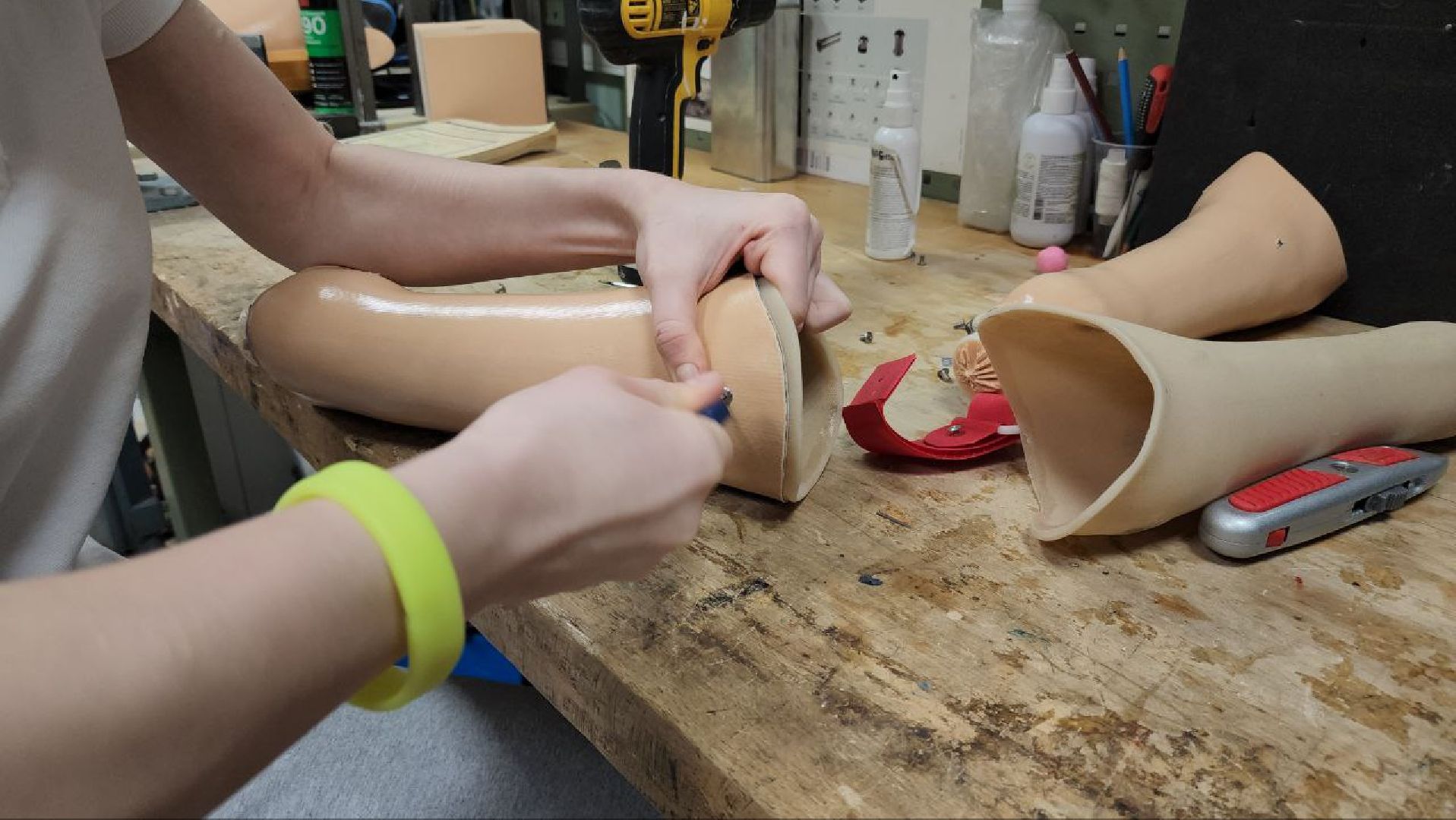 мытищи, Орто-Космос, Орто-спорт, протезы, протезирование, ортезы, Школа ходьбы,