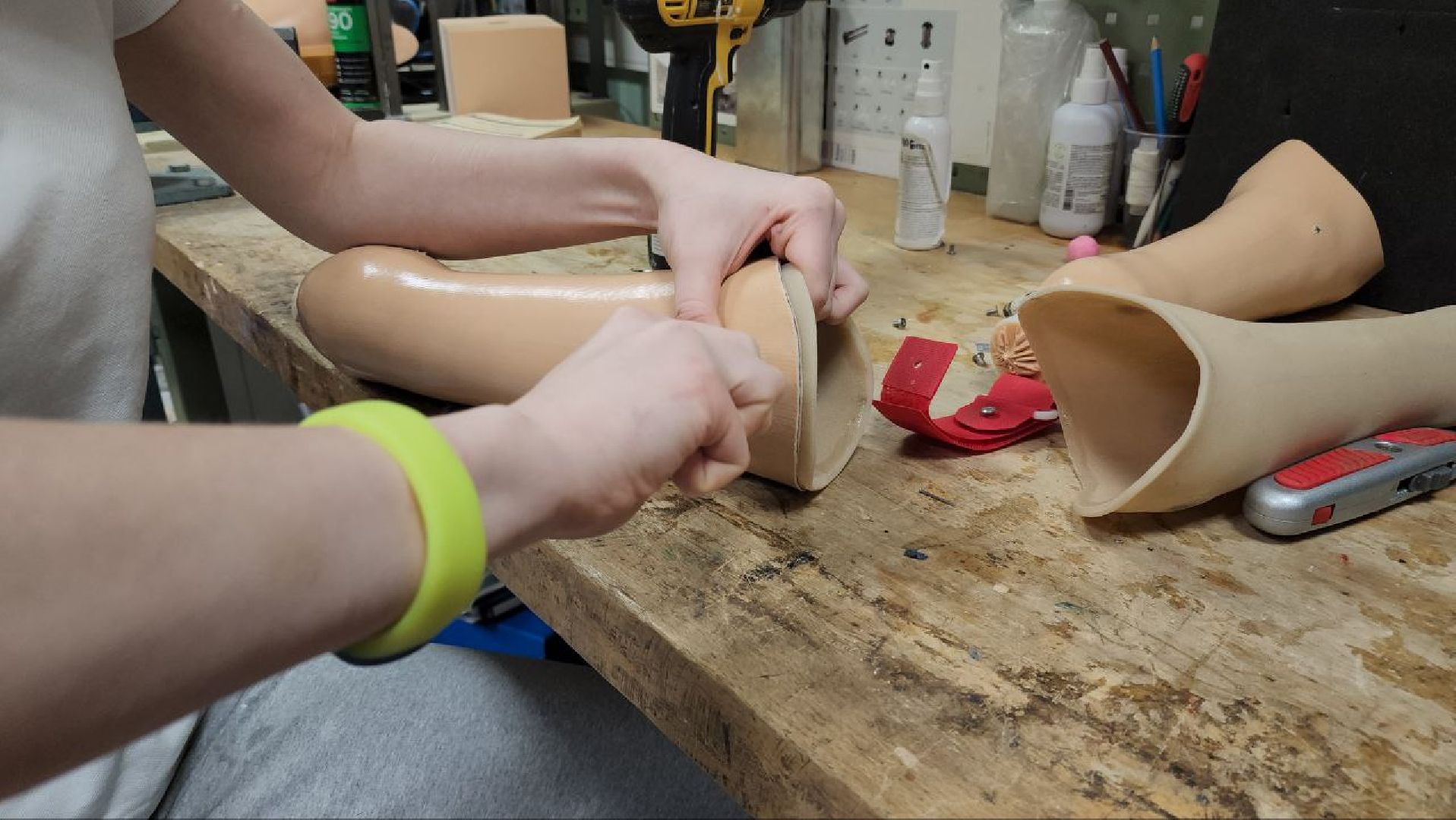 мытищи, Орто-Космос, Орто-спорт, протезы, протезирование, ортезы, Школа ходьбы,