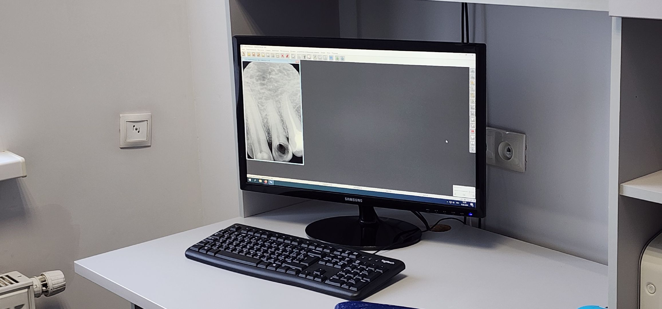 стоматология, Минздрав Подмосковья, Поликлиника перезагрузка, Домодедово, филиал Южный,