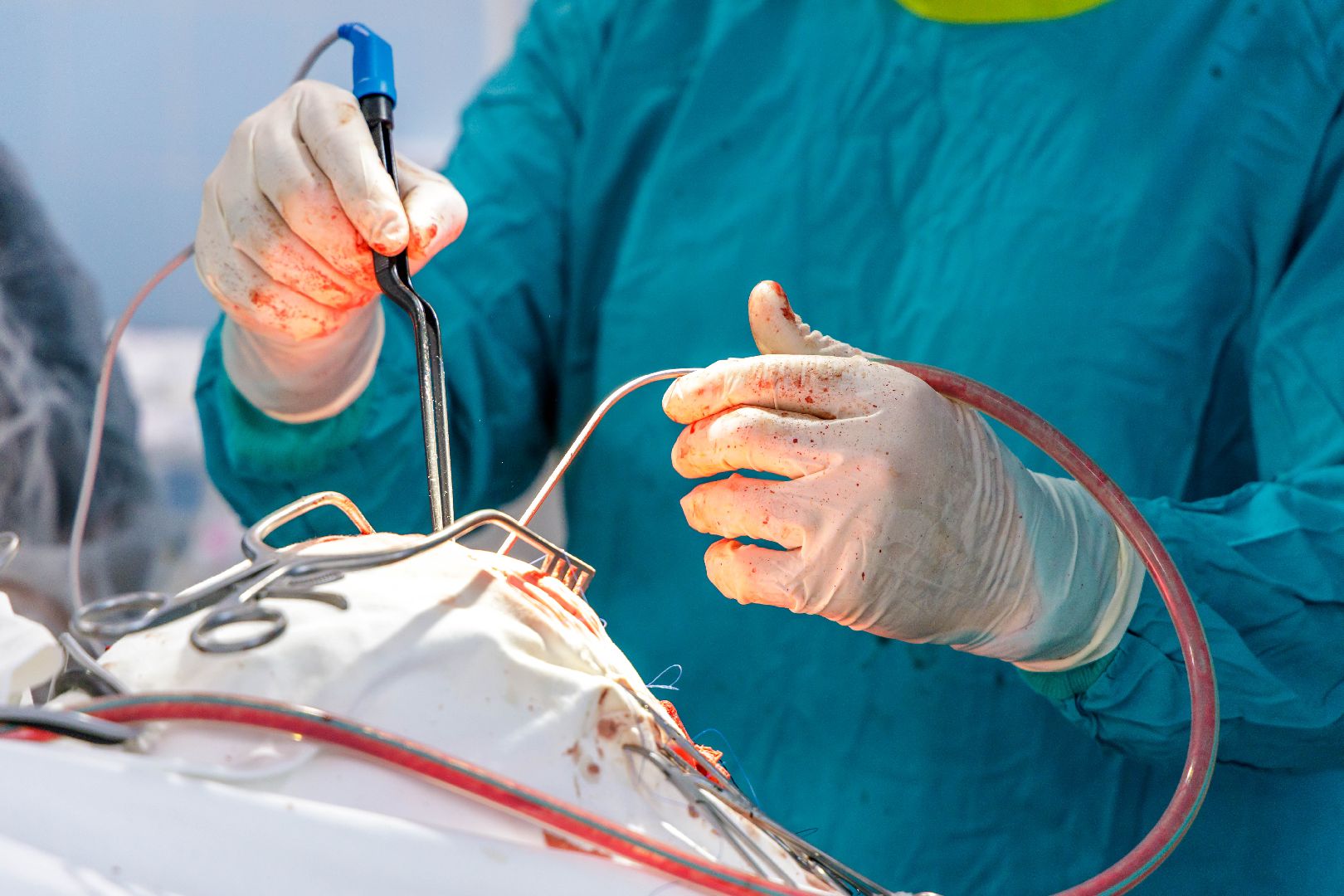 люберцы, люберецкая областная больница, нейрохирургия,