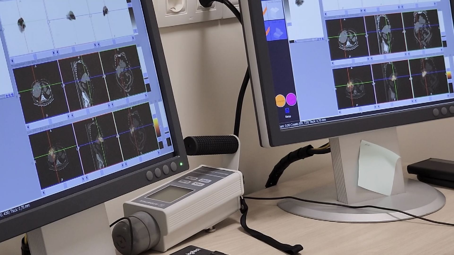 химки, медицина, операция, рак, клиника,