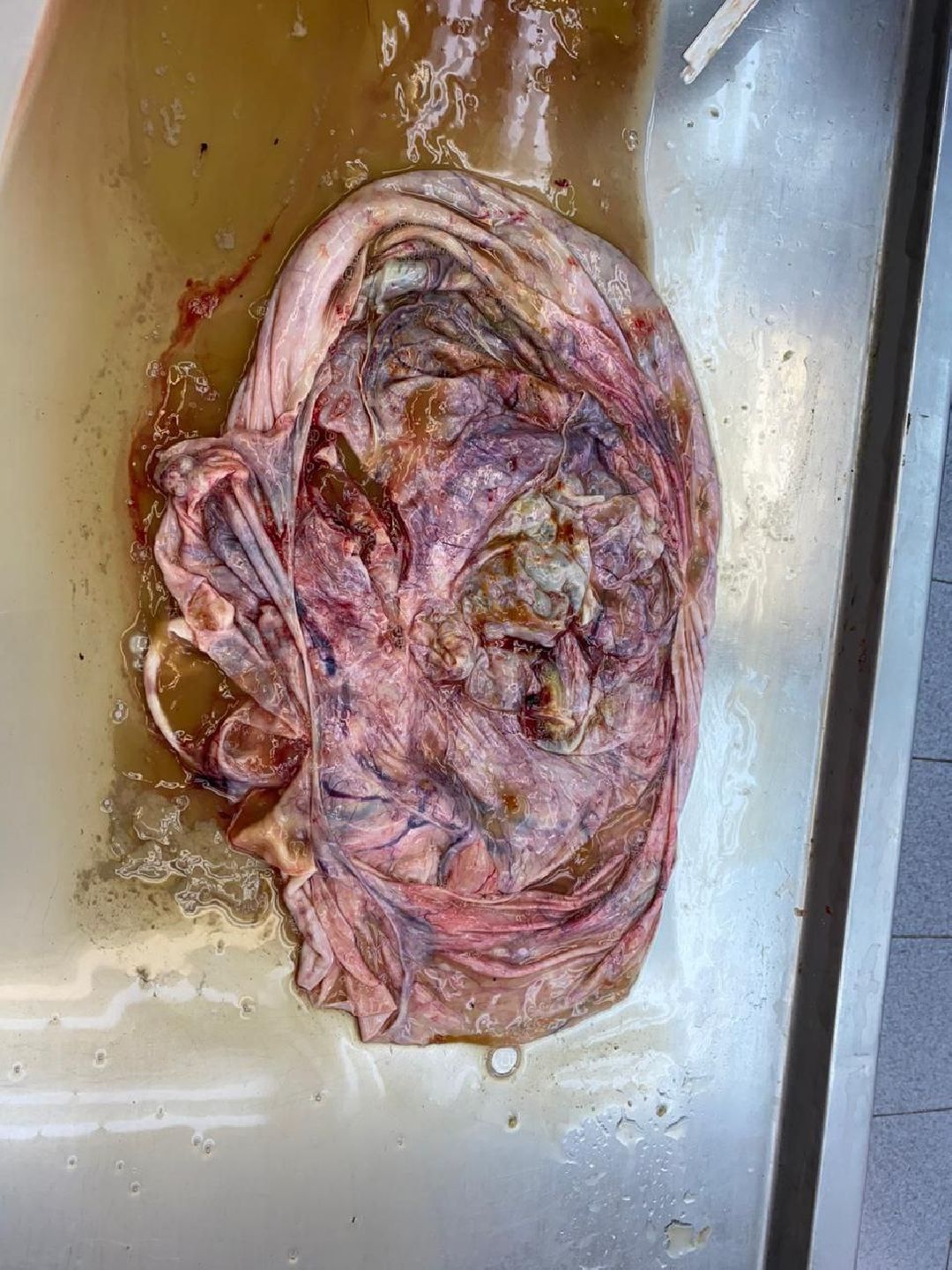 Подольск, медицина, опухоль, здоровье