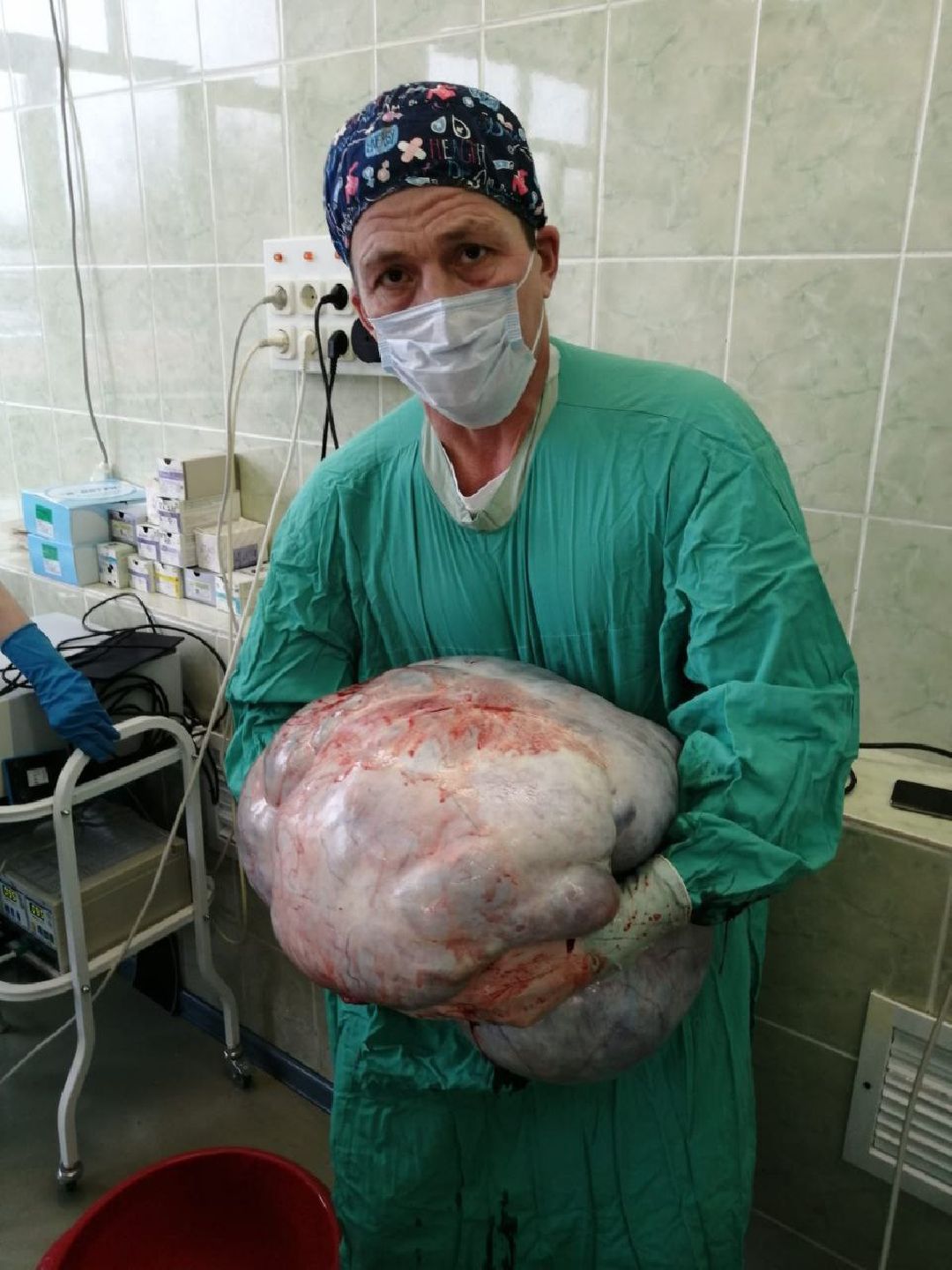 Подольск, медицина, опухоль, здоровье