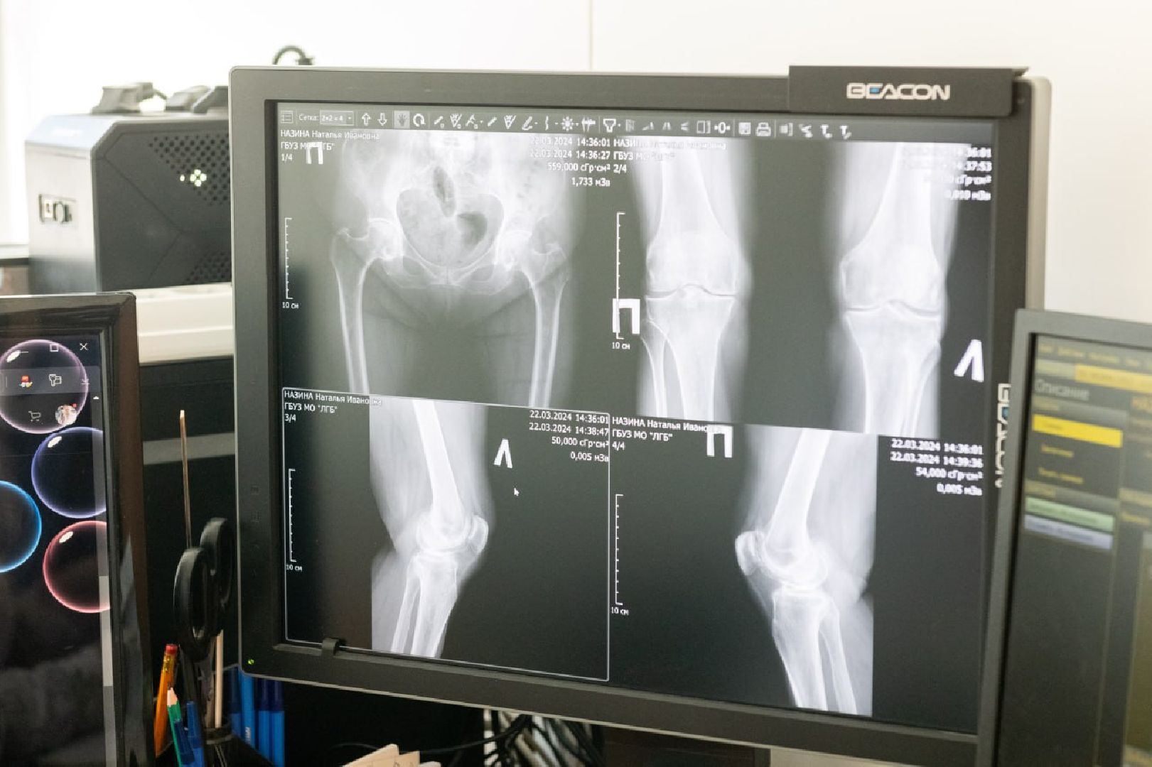 лыткарино, медицина, рентген-кабинет,