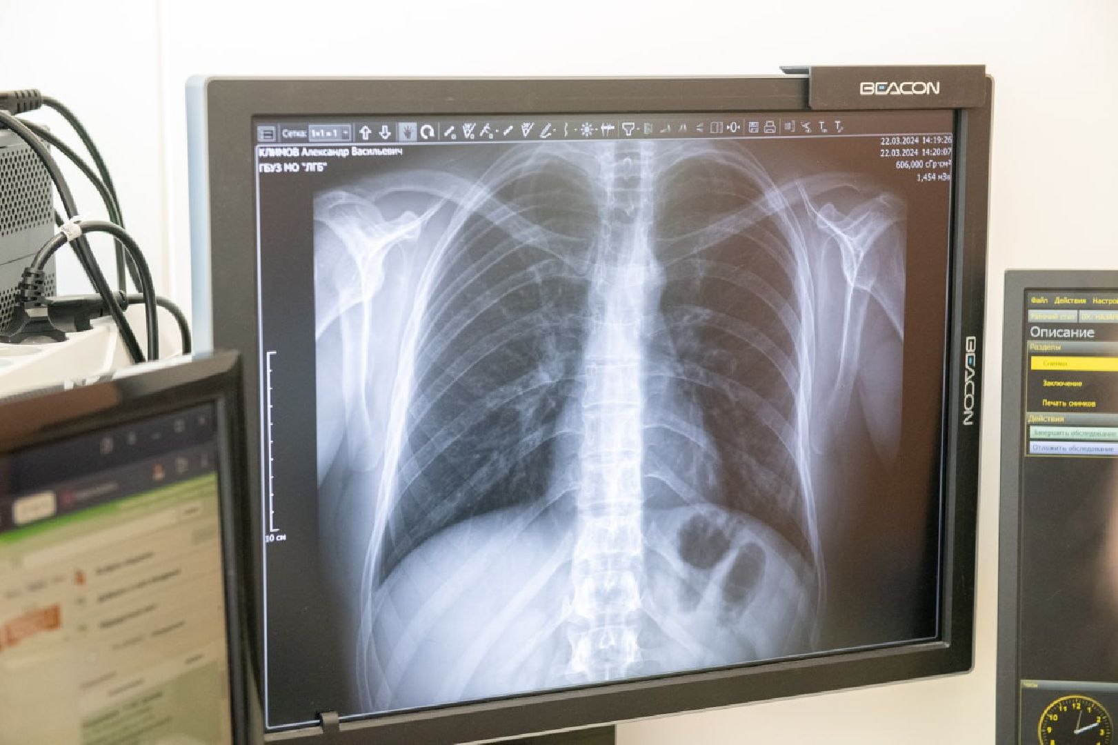 лыткарино, медицина, рентген-кабинет,