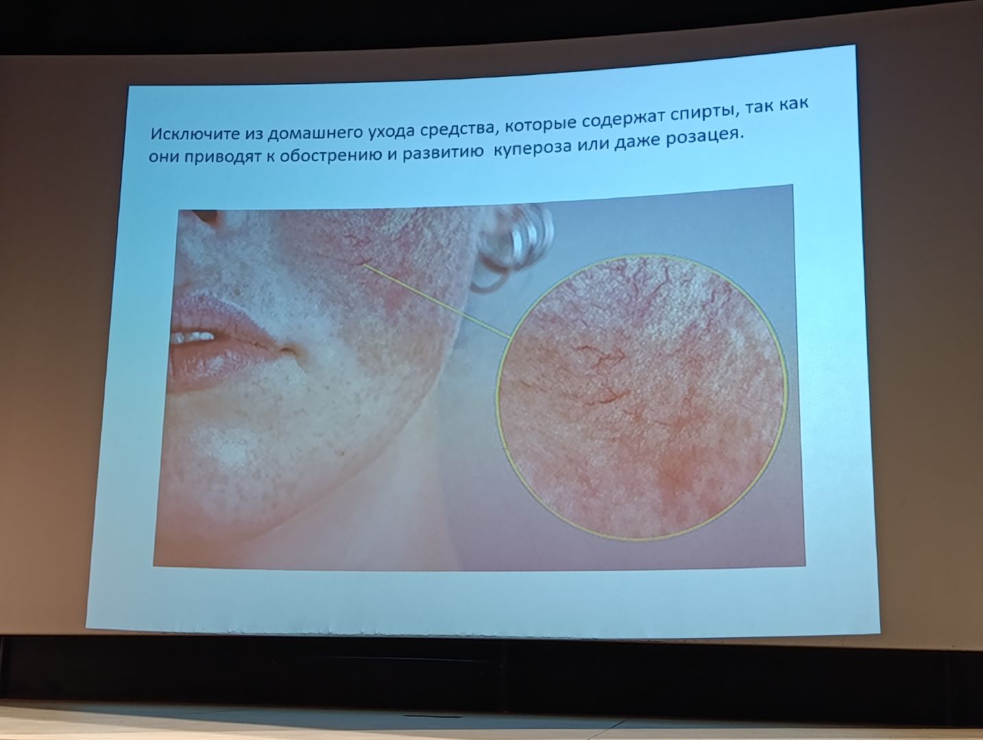 Бронницы, Женское здоровье, Конференция о здоровье, Советы по уходу за кожей,