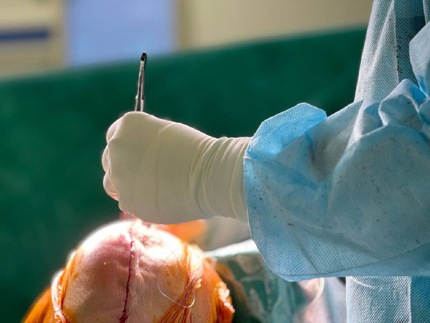 Жуковская ОКБ, день открытых дверей, отделение травматологии и ортопедии, Алик карпенко, петр бондаренко, консультации, ОМС,