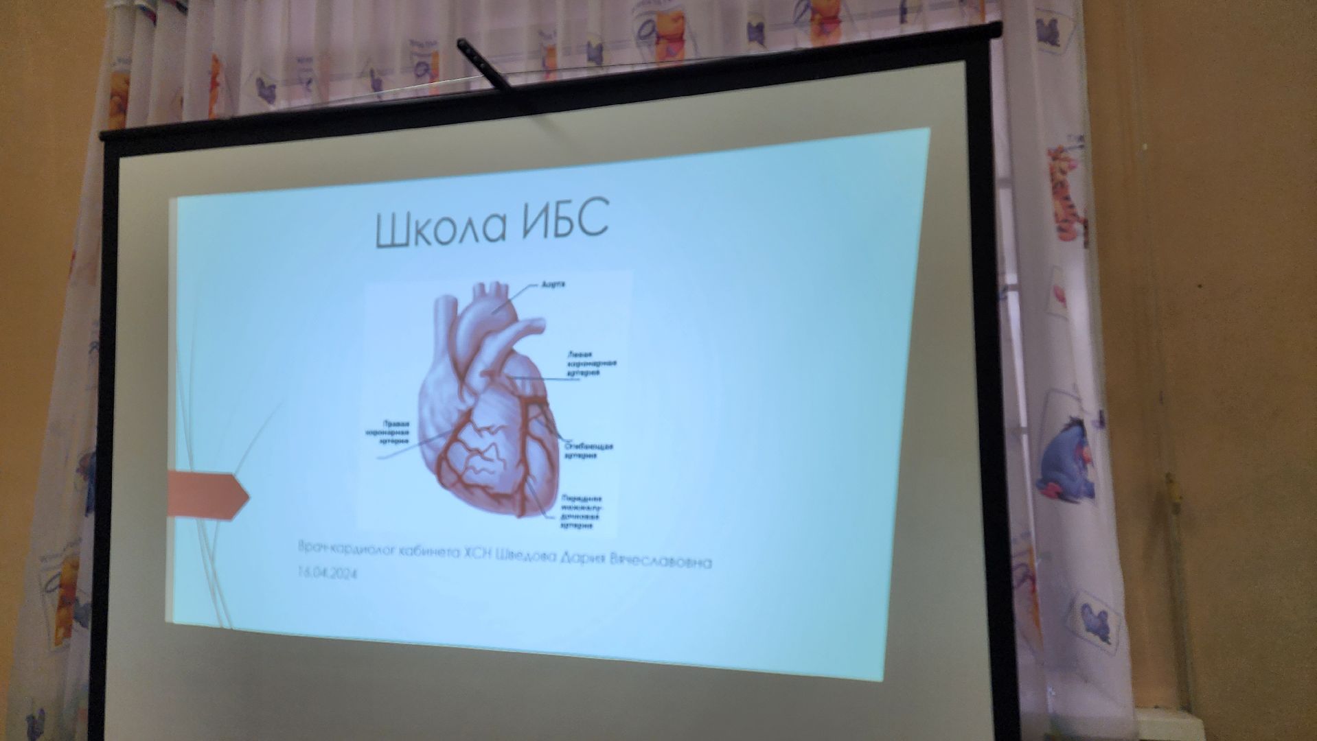 ИБС, ишемическая болезнь сердца, лекция, поликлиника Жуковской ОКБ, Дария Шведова, Дзержинского 14,