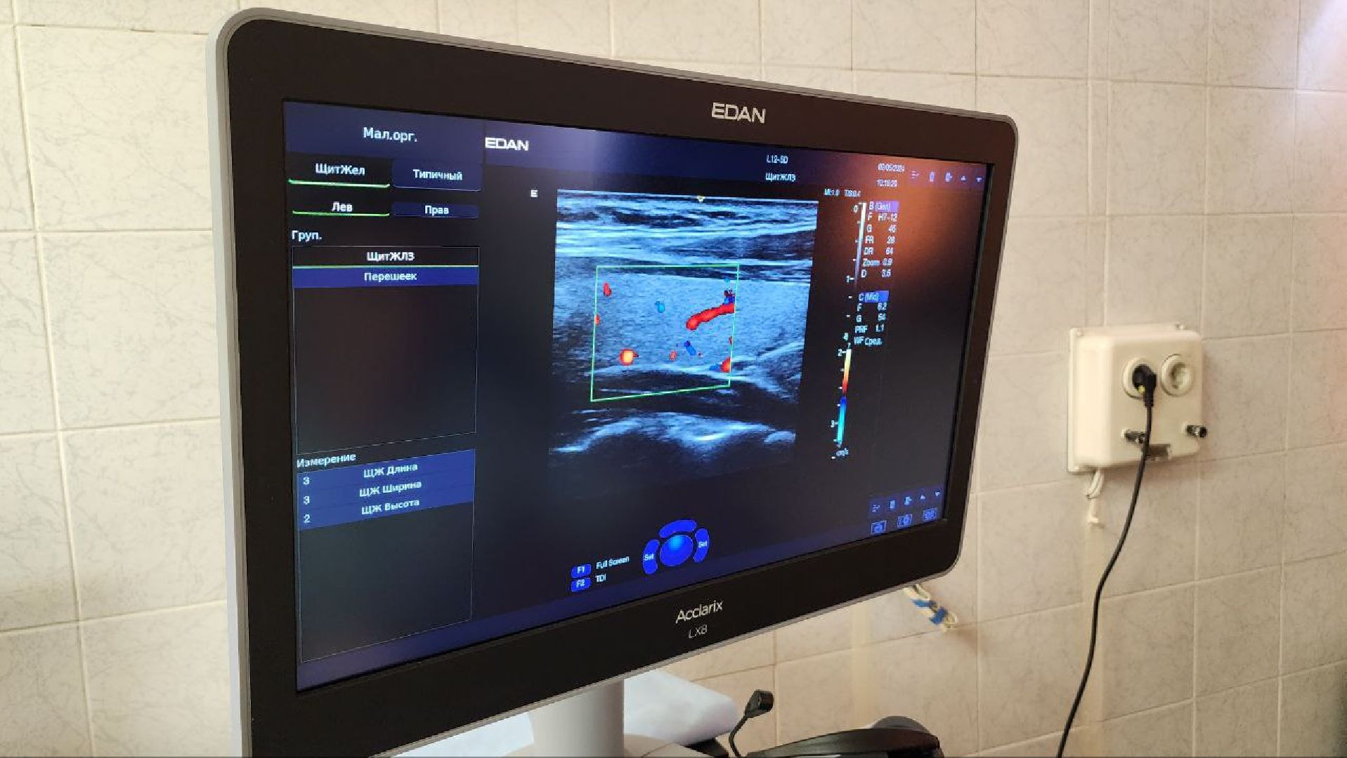 Люберцы, узи, люберецкая областная больница,новый врач,