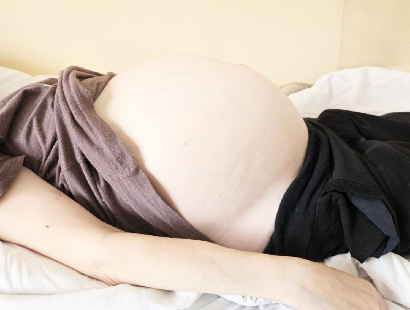 балашиха, Подмосковье, Онкология, гигантская опухоль, московский областной онкологический диспансер,