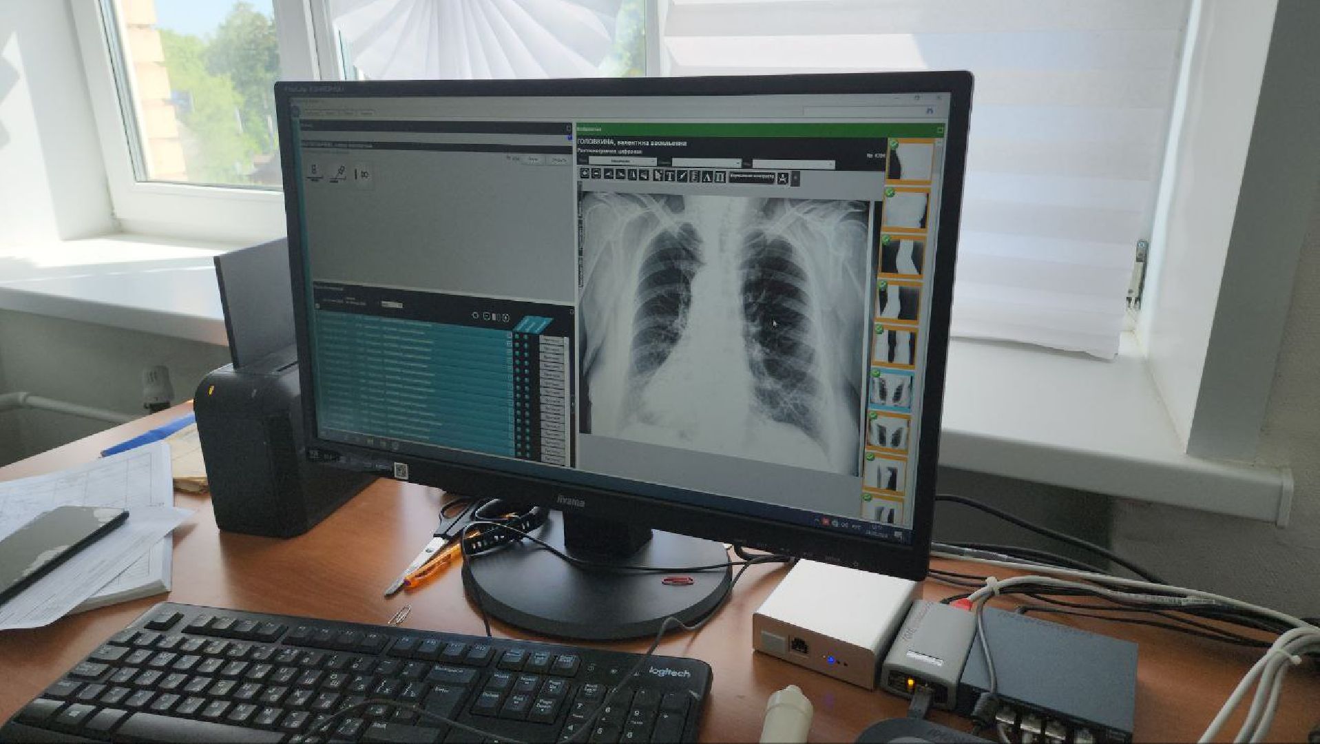 люберцы, выездная администрация, ремонт поликлиники, цифровой рентген-аппарат, малаховка,