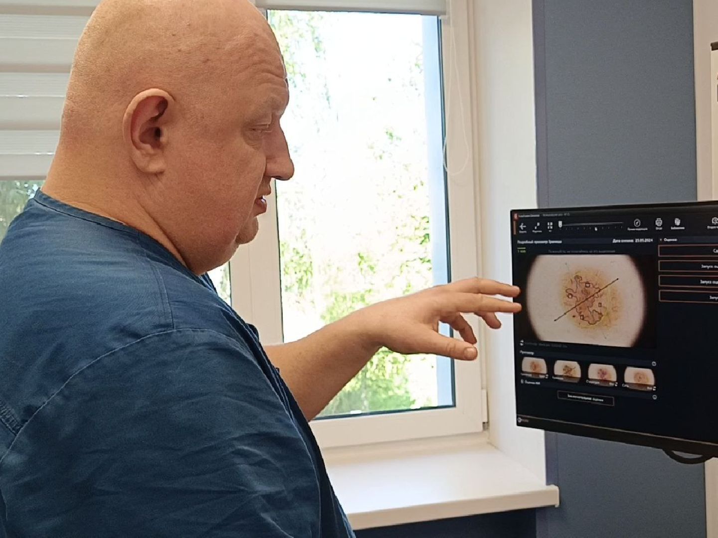 Солнечногорск, Медицина, день открытых дверей, Меланома, Онкологическая помощь,