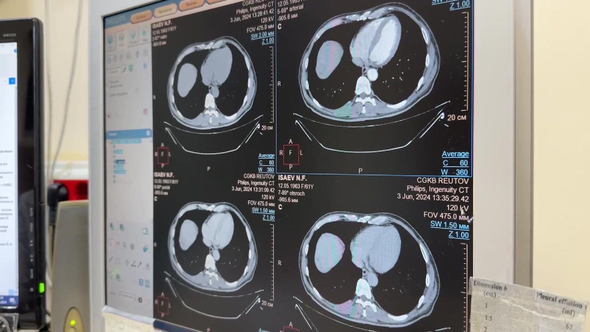 Реутов, медицина, жилье для врачей, социальная ипотека, госпрограмма,