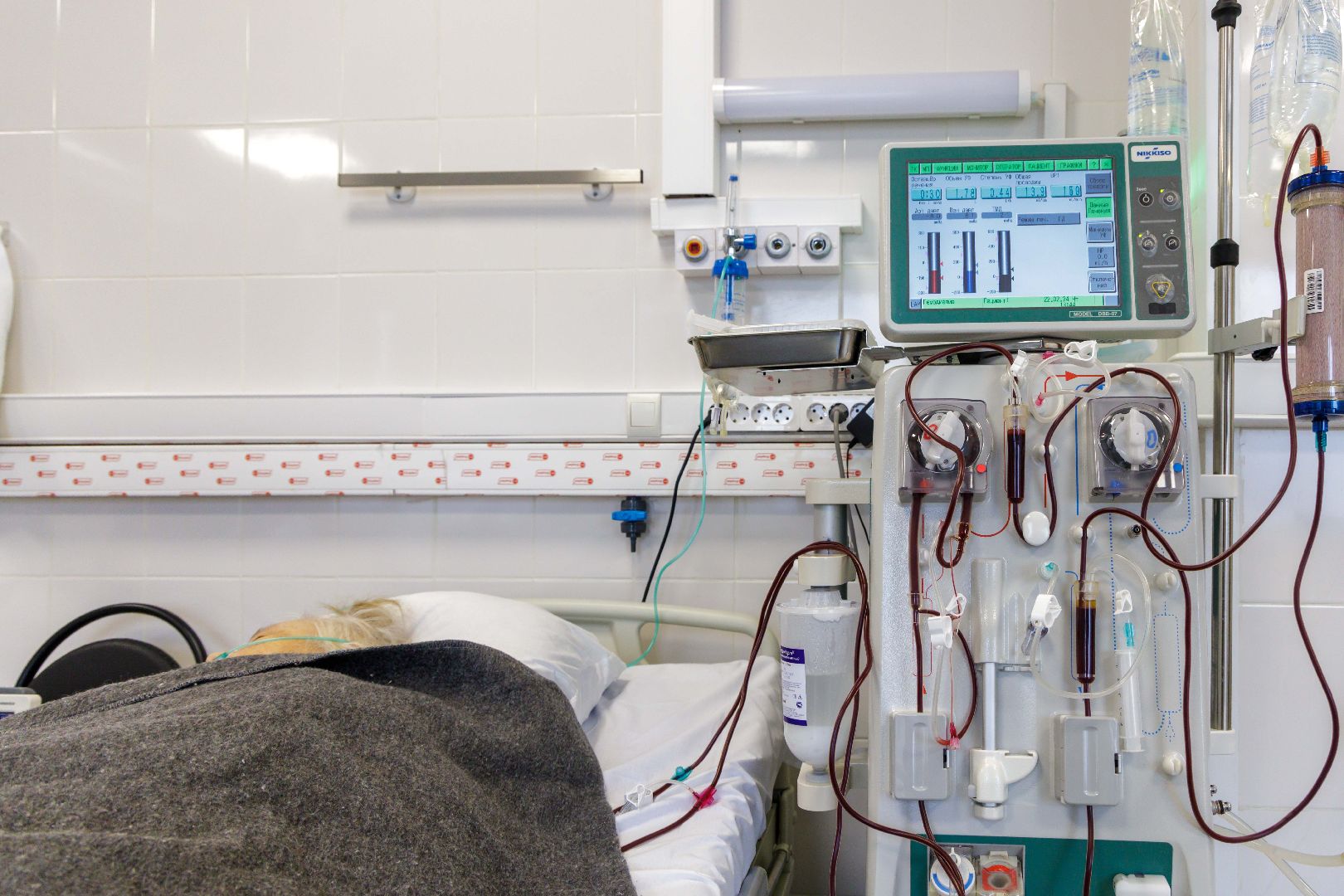 Люберцы, Люберецкая областная больница, гемодиализ,