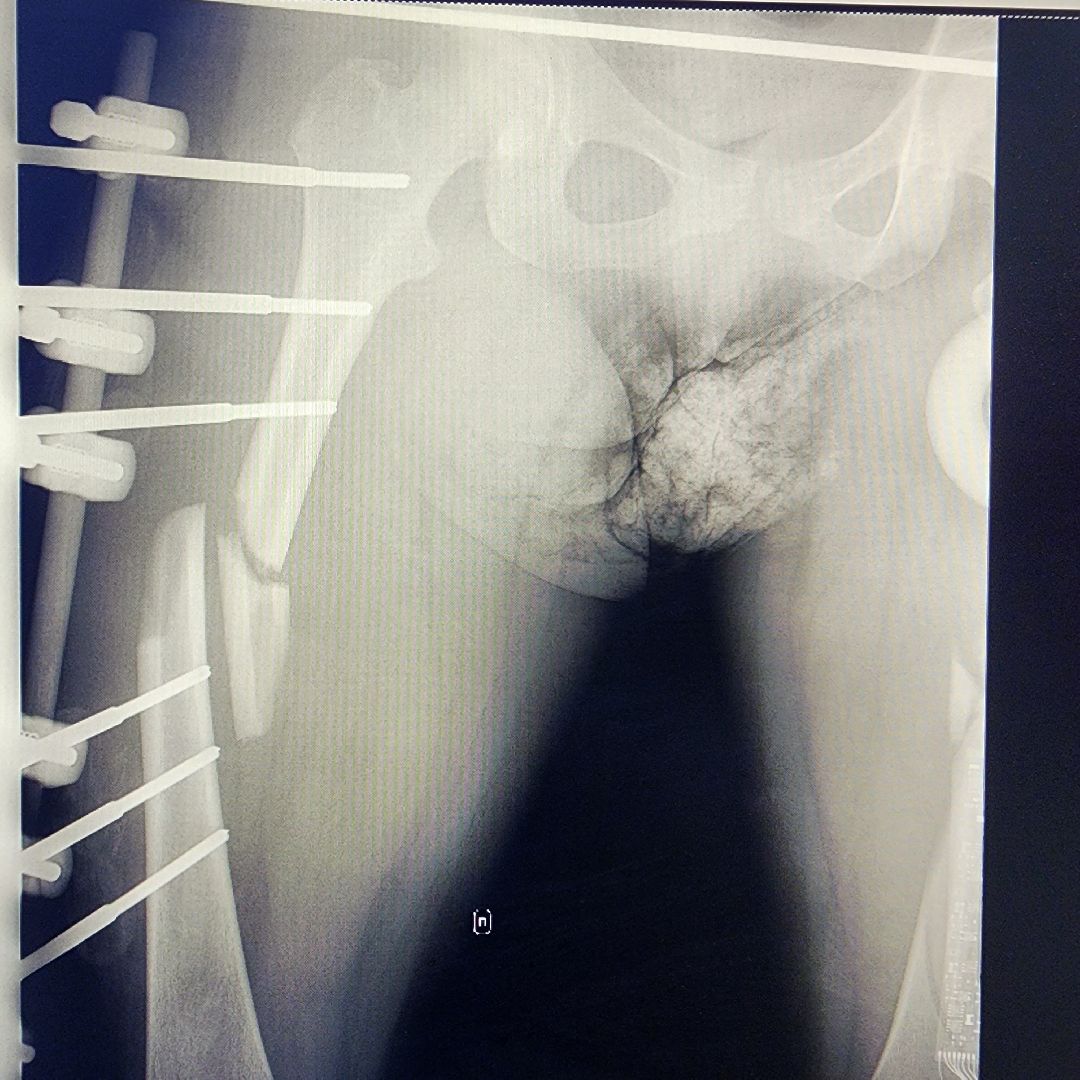 Солнечногорск, медицина, травматология, история спасения,