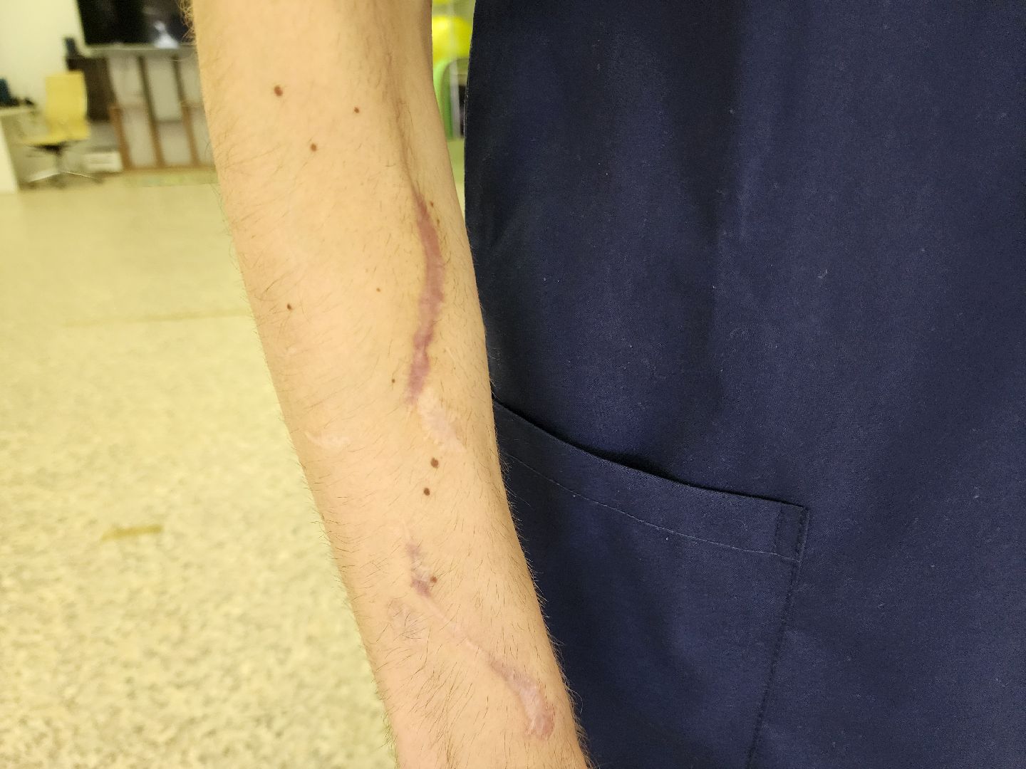 Подольск, Ясенки, Сво, реабилитация участников сво,