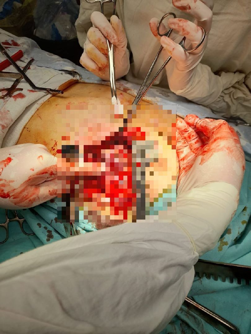 спасение, ножевое ранение, врачи,