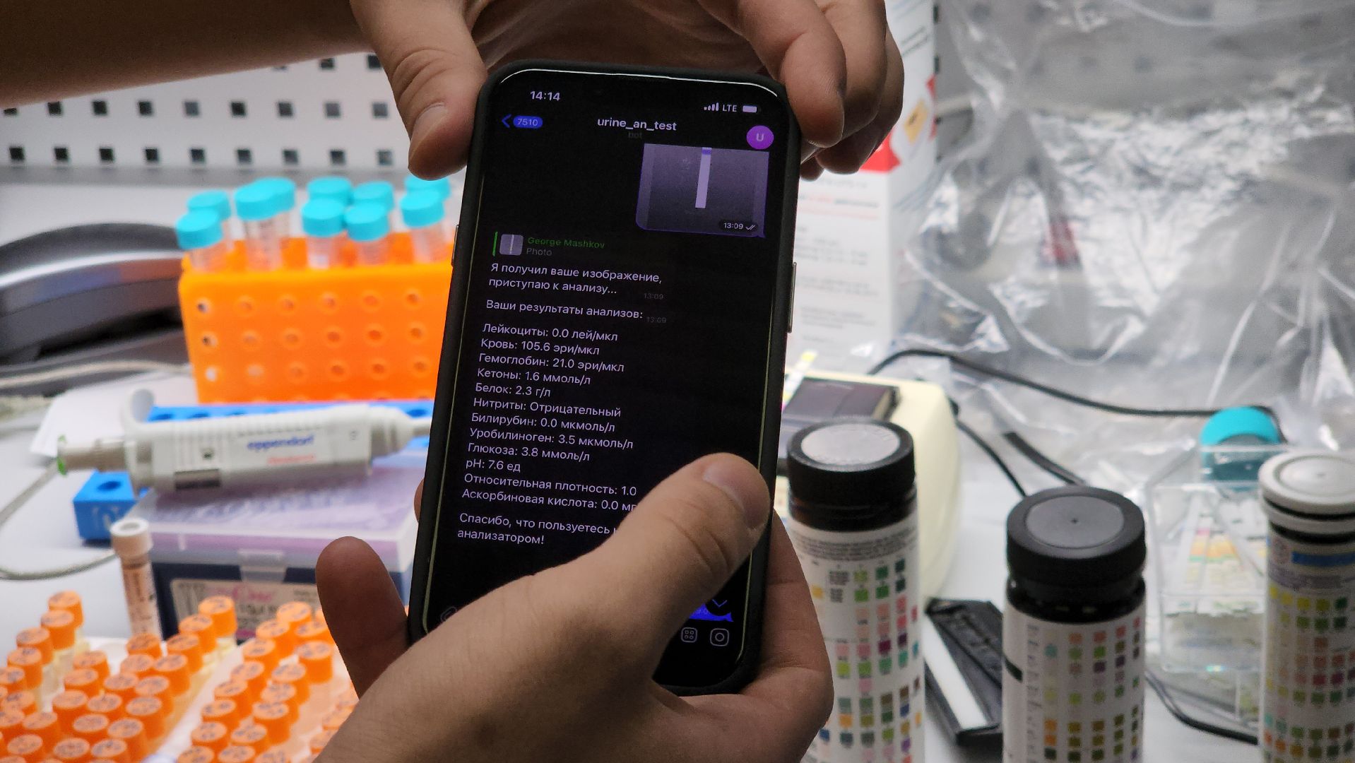 долгопрудный, мфти, студенческий стартап, анализ мочи,