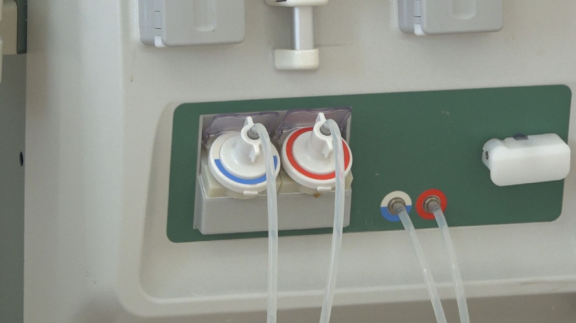 Домодедовская больница, диализ, почечная недостаточность