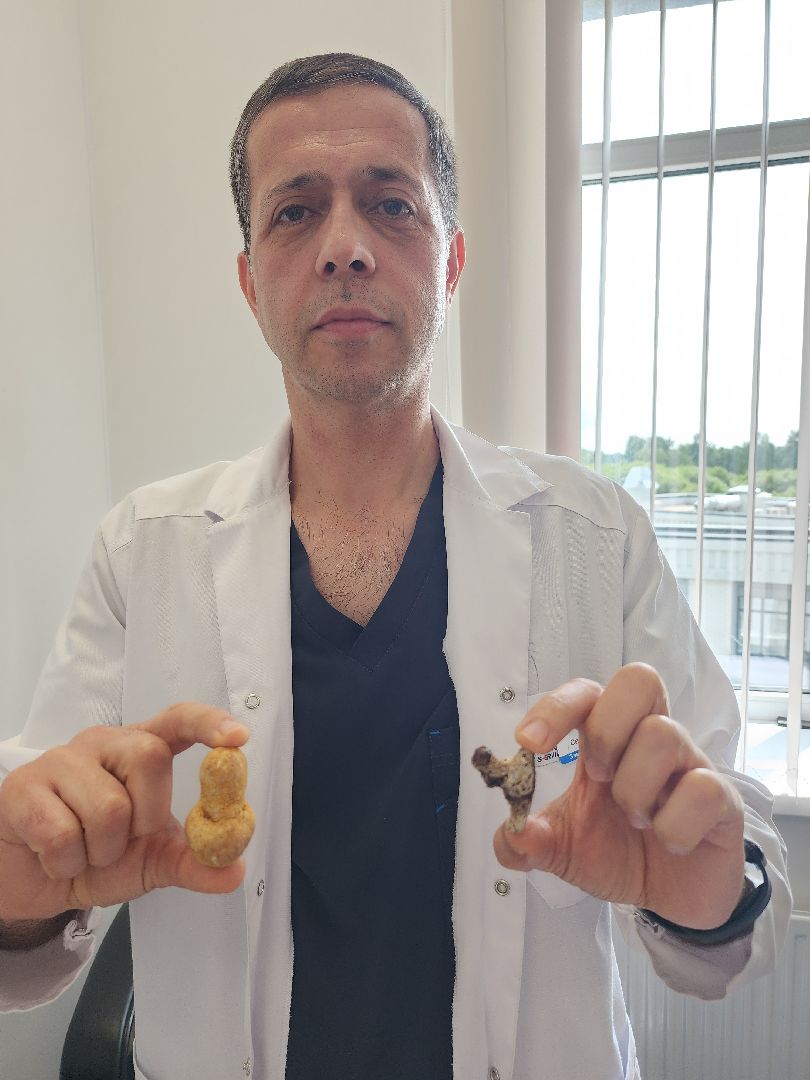 урология, камни в почках, профилактика болезней, советы врачей,