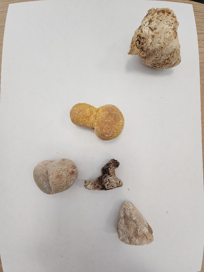 урология, камни в почках, профилактика болезней, советы врачей,