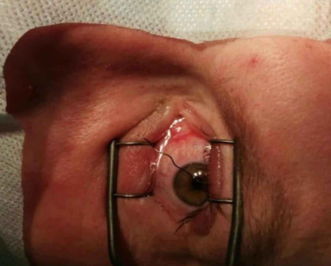 травмы, врачи, зрение, уникальный случай,