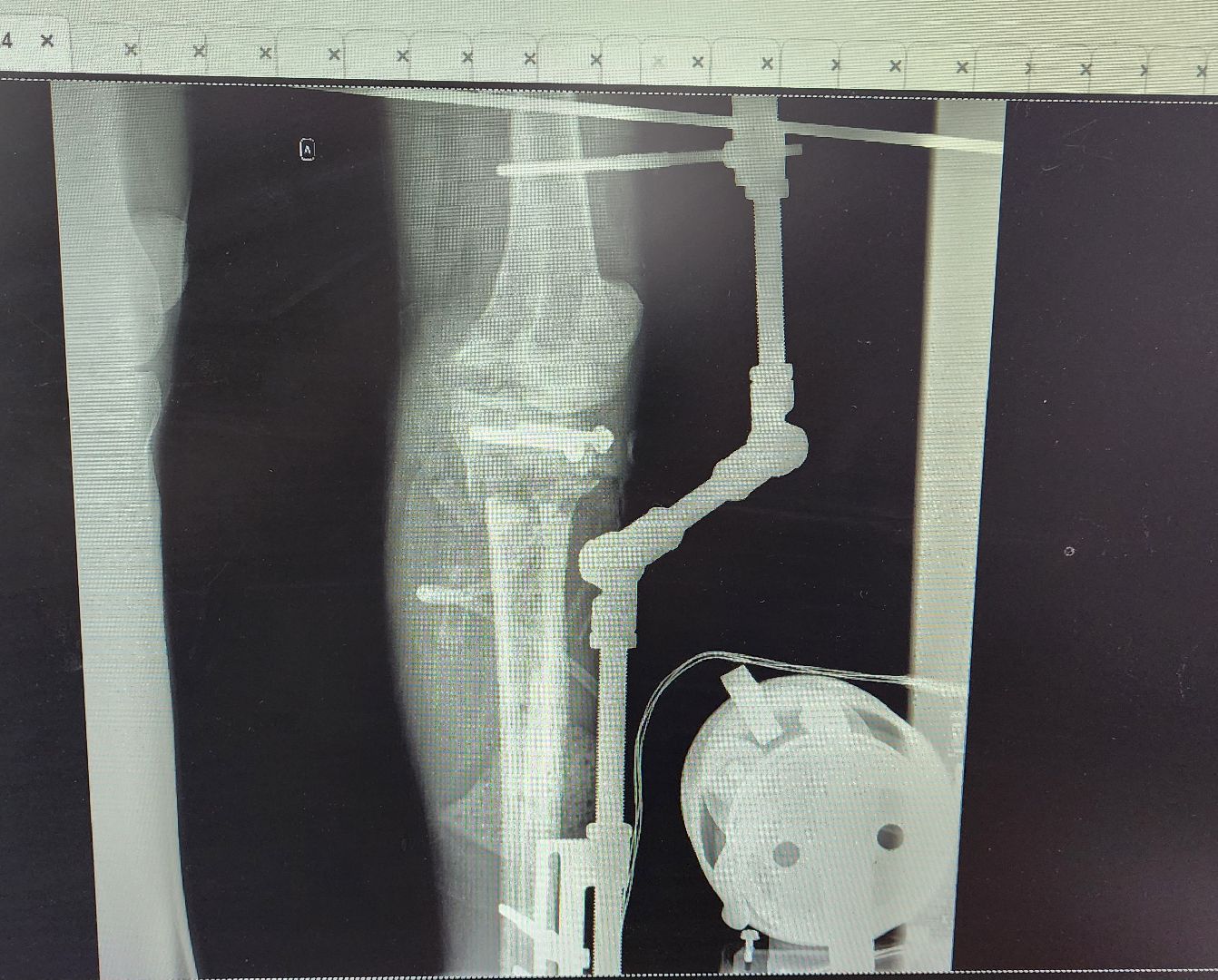Солнечногорск, медицина, травматология, ДТП,