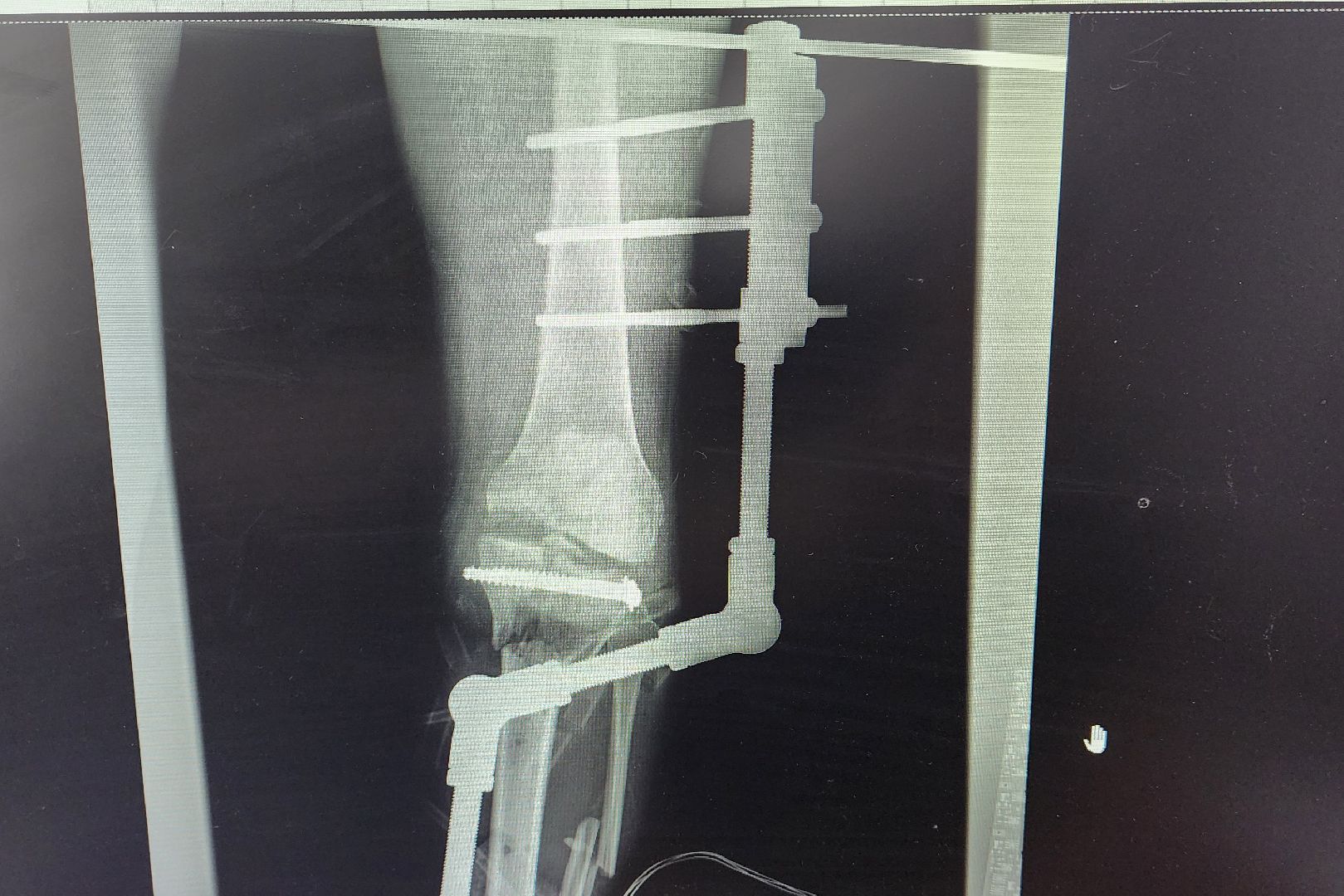 Солнечногорск, медицина, травматология, ДТП,