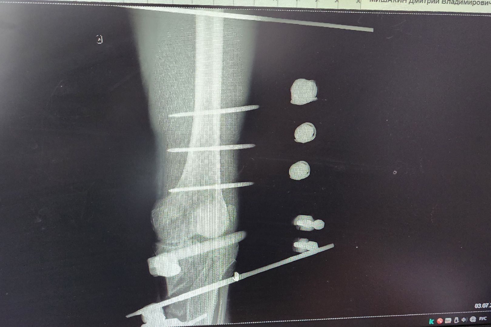 Солнечногорск, медицина, травматология, ДТП,