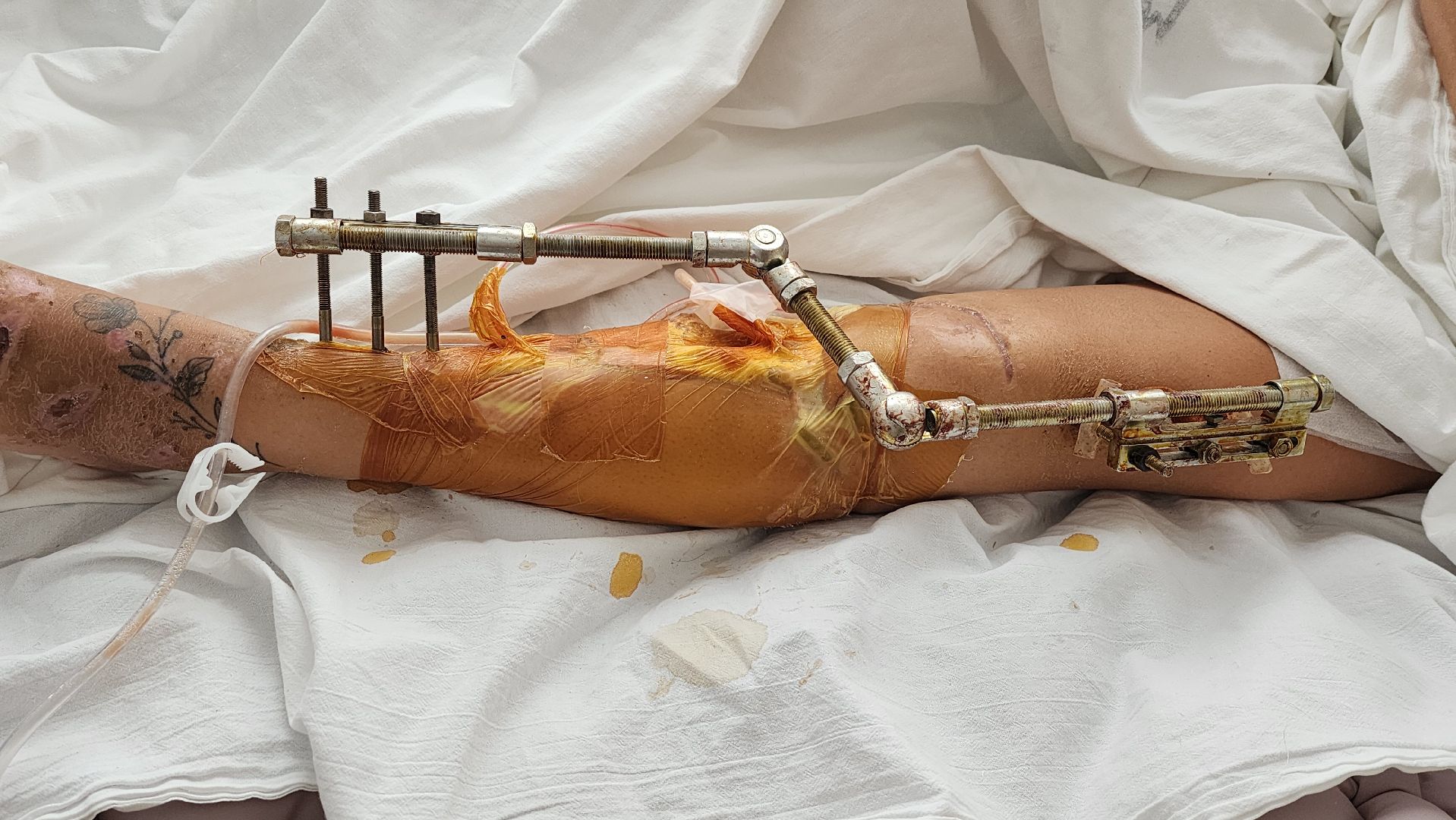 Солнечногорск, медицина, травматология, ДТП,