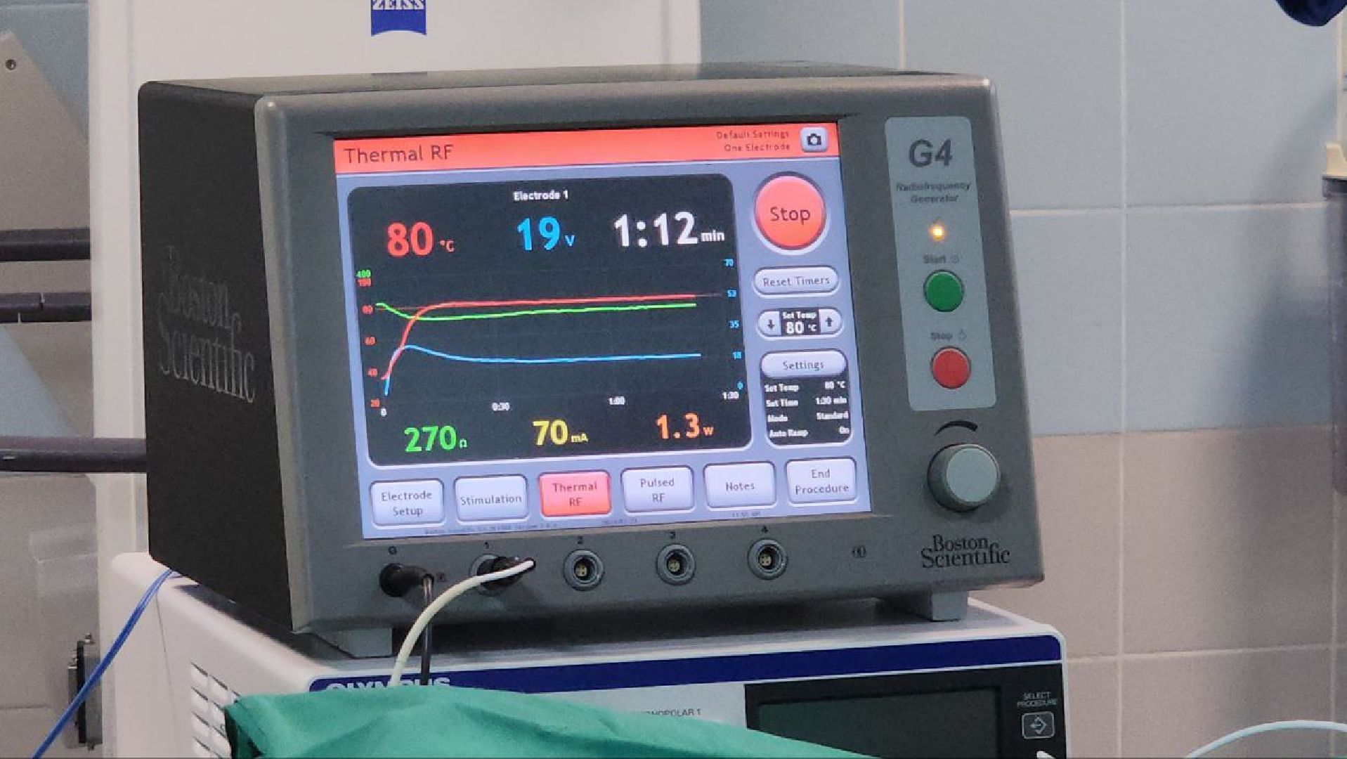 люберцы, люберецкая больница, нейрохирурги, новое оборудование, операция,