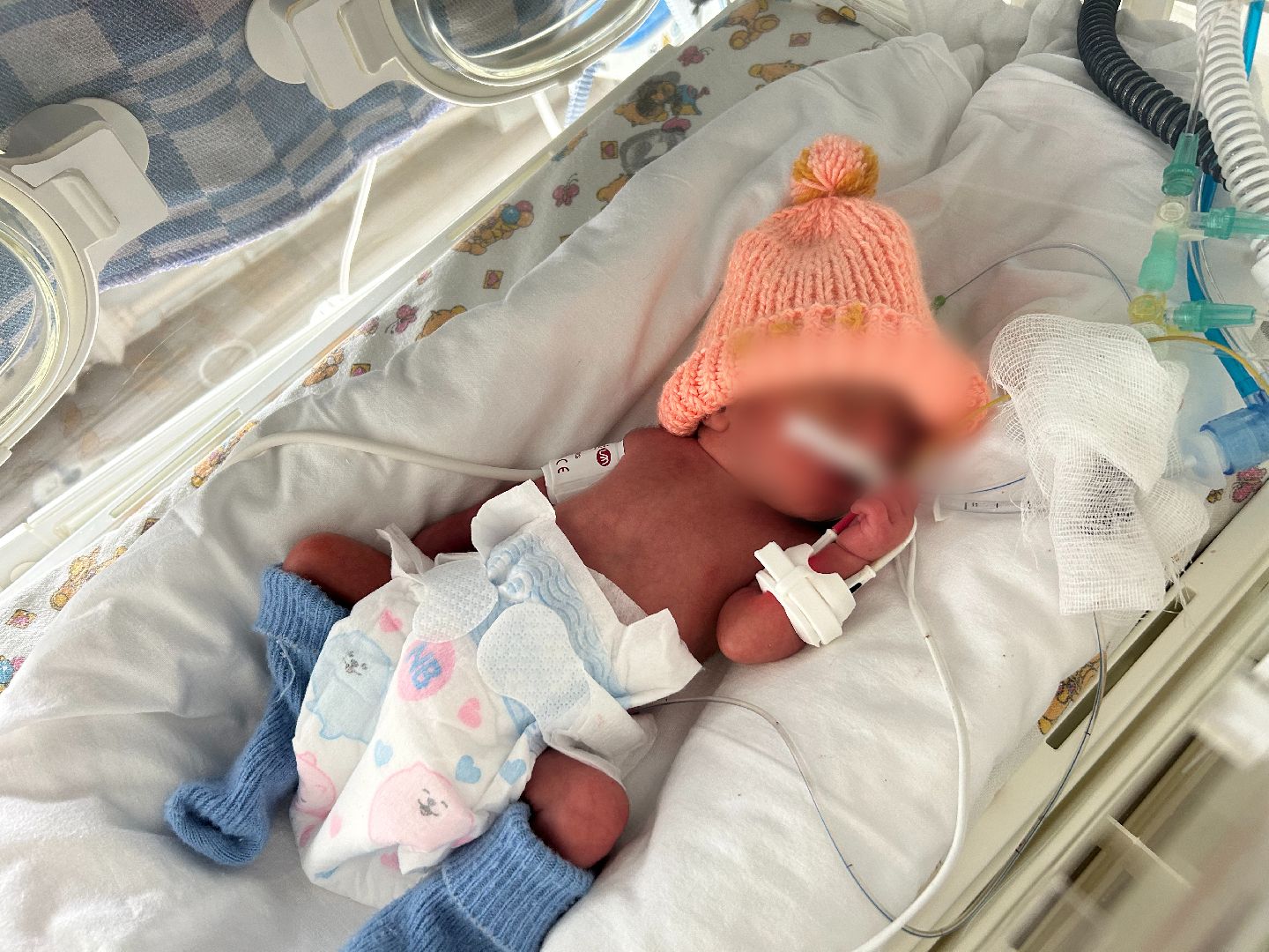 Солнечногорск, медицина, роддом, история спасения,