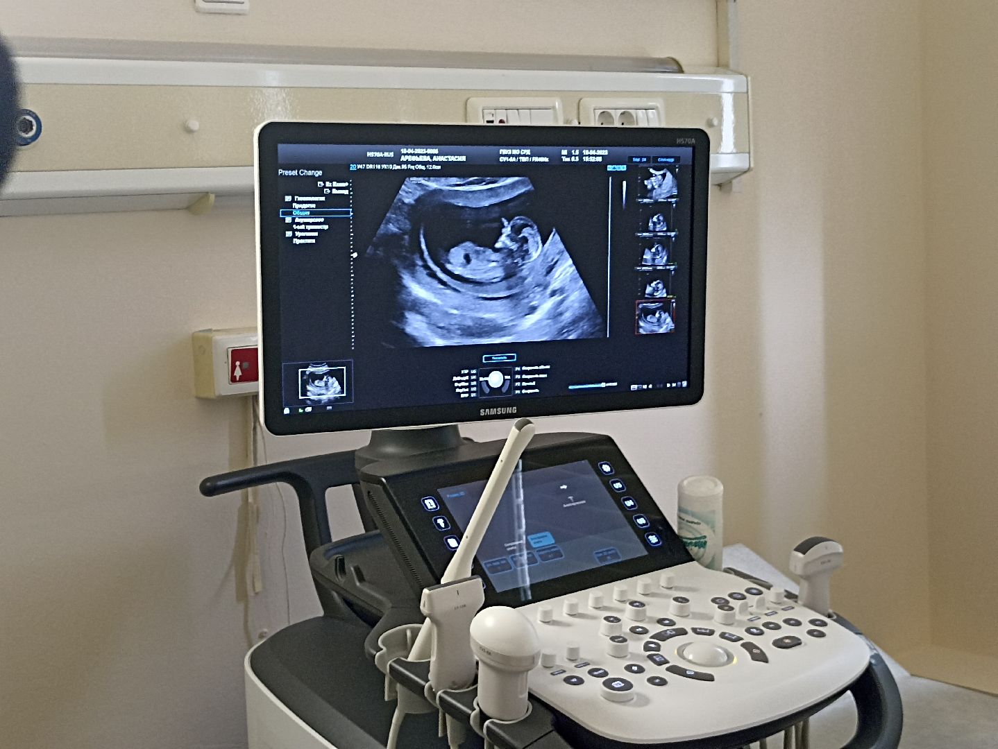 Серпухов, роддом, Подмосковье, оборудование, новорожденные,